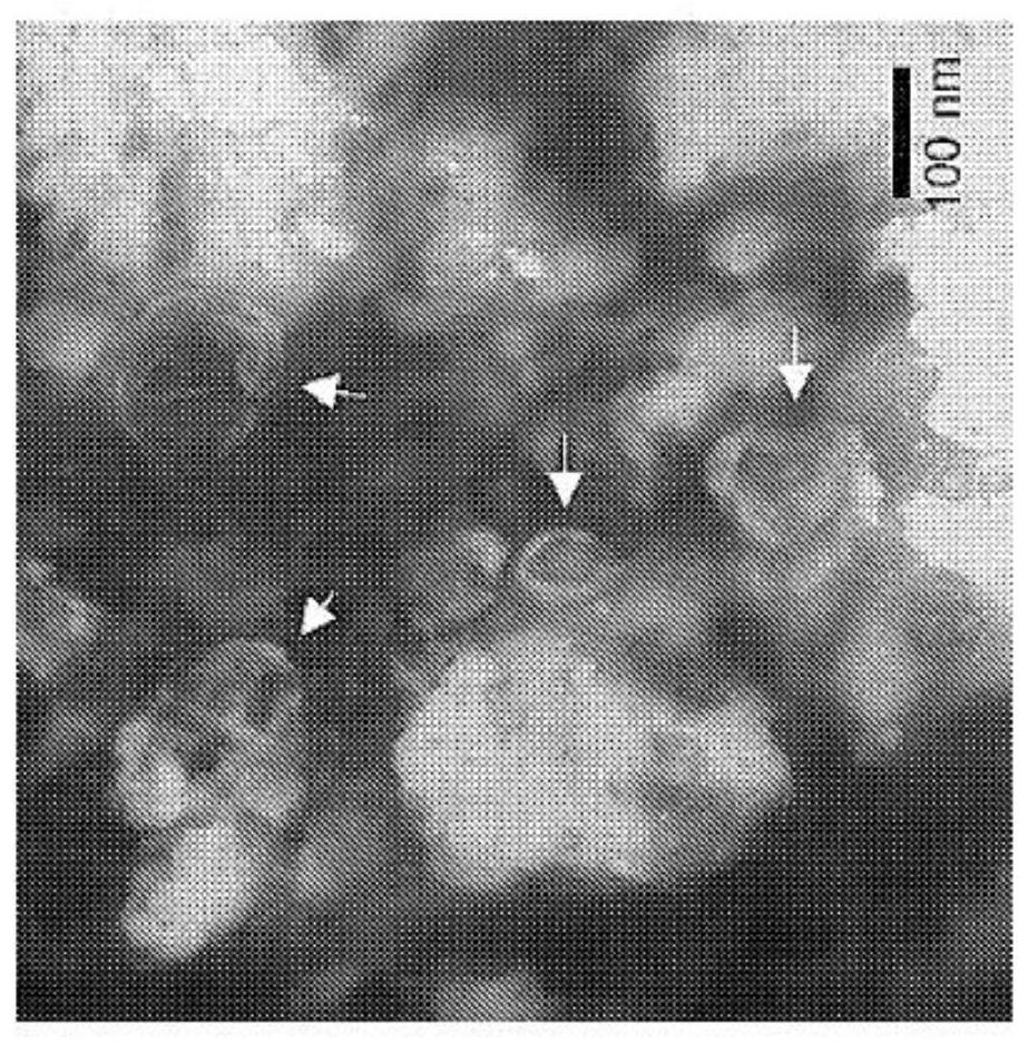 Matrix bound vesicles (MBVS) containing il-33 and their use