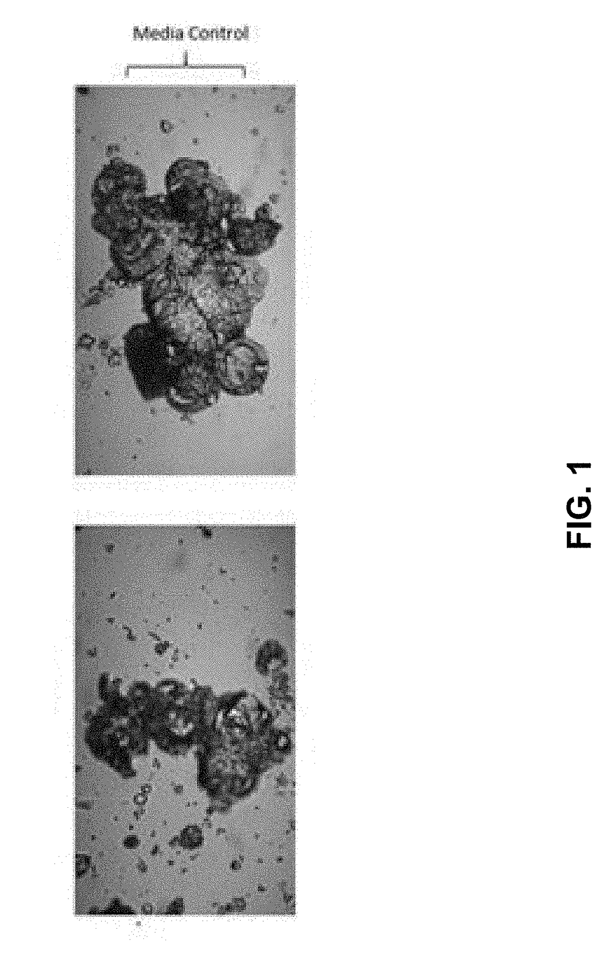 Methods for the production and use of myceliated high protein food compositions