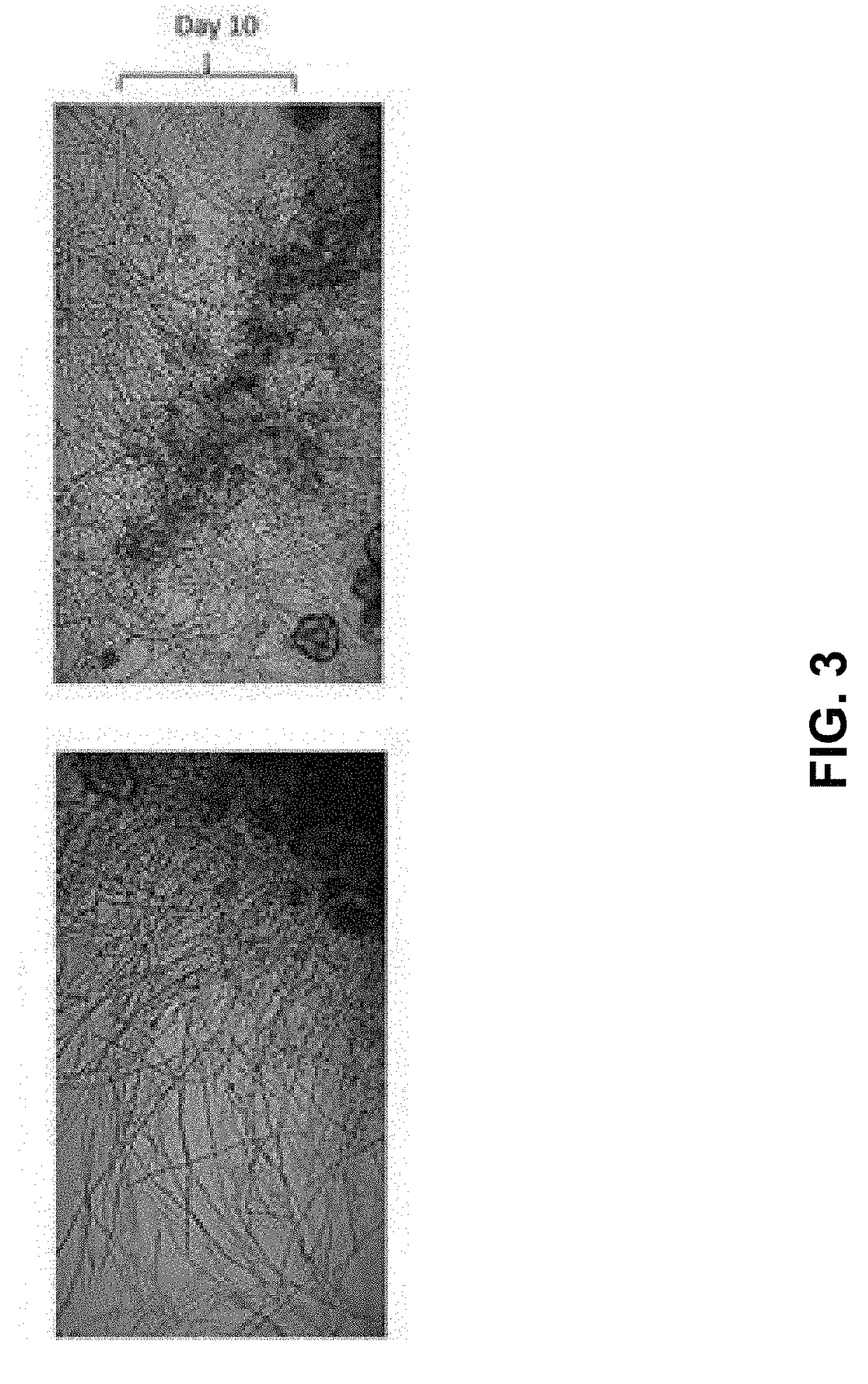 Methods for the production and use of myceliated high protein food compositions