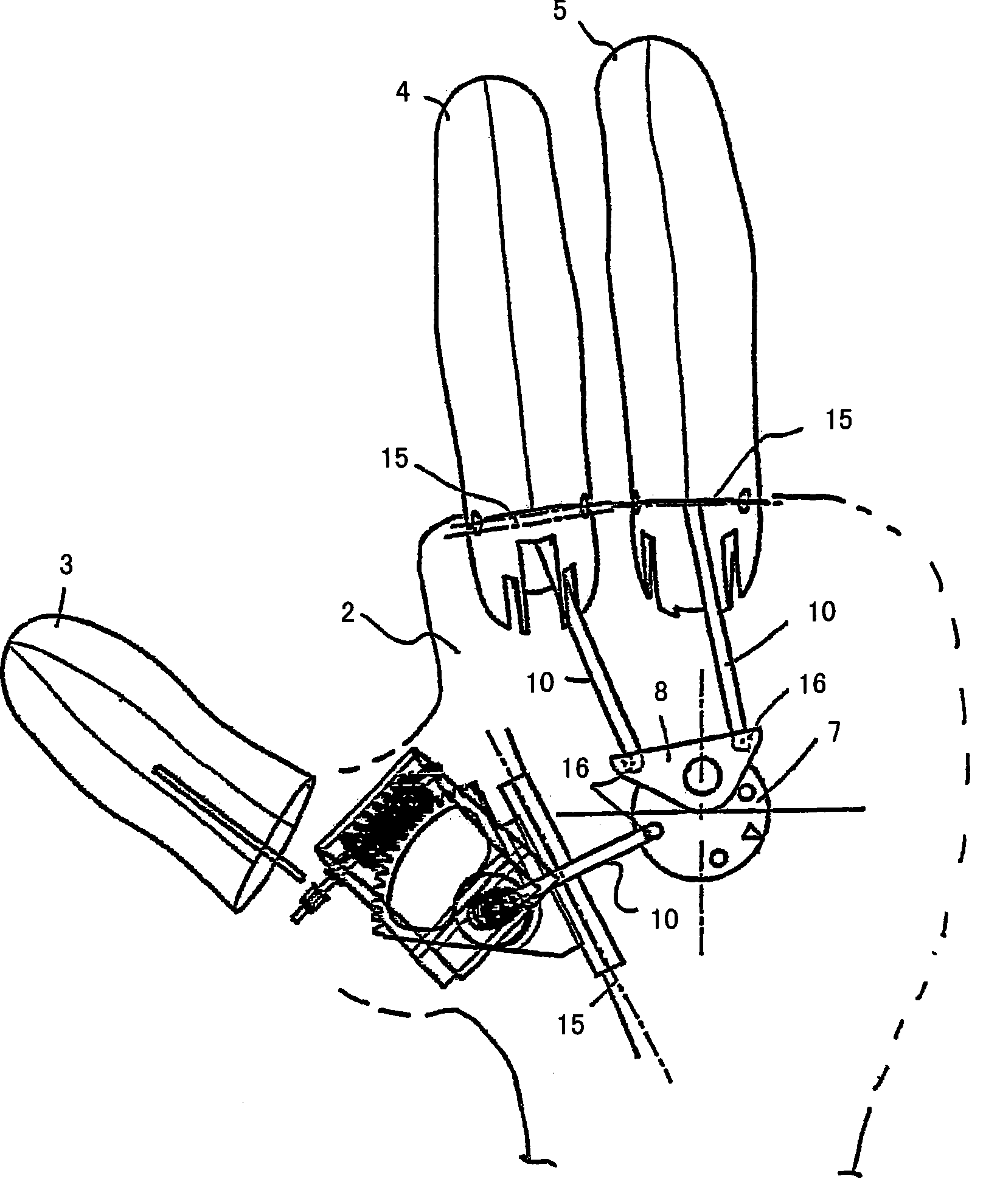 Hand prosthesis