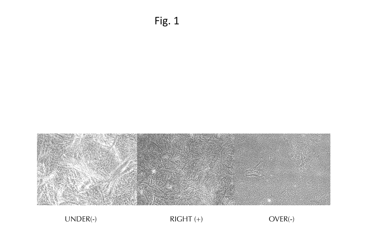 Injectable composition for in-situ repair and regeneration of an injured ligament or tendon and methods of use