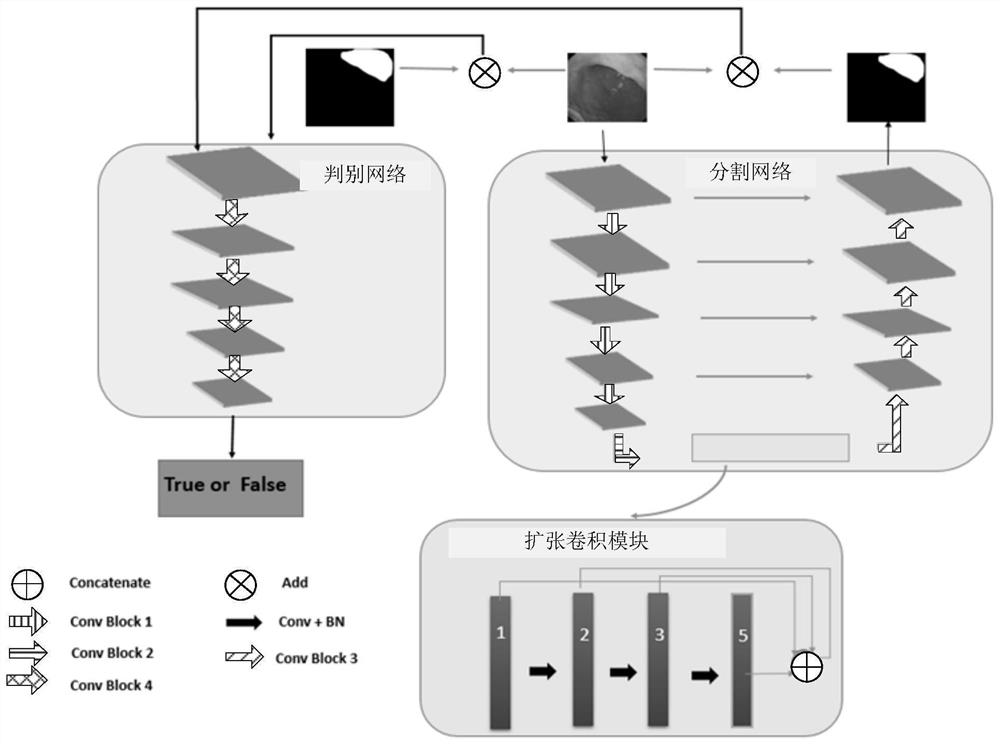 Gastric lesion segmentation method and system based on generative adversarial network