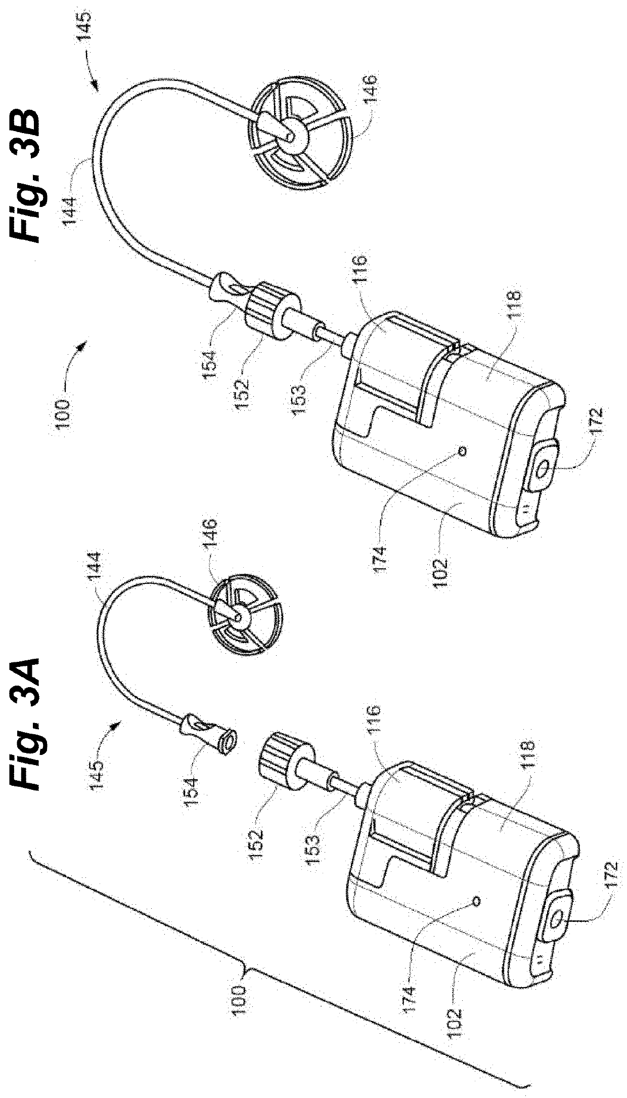 Systems and methods for automated insulin delivery response to meal announcements