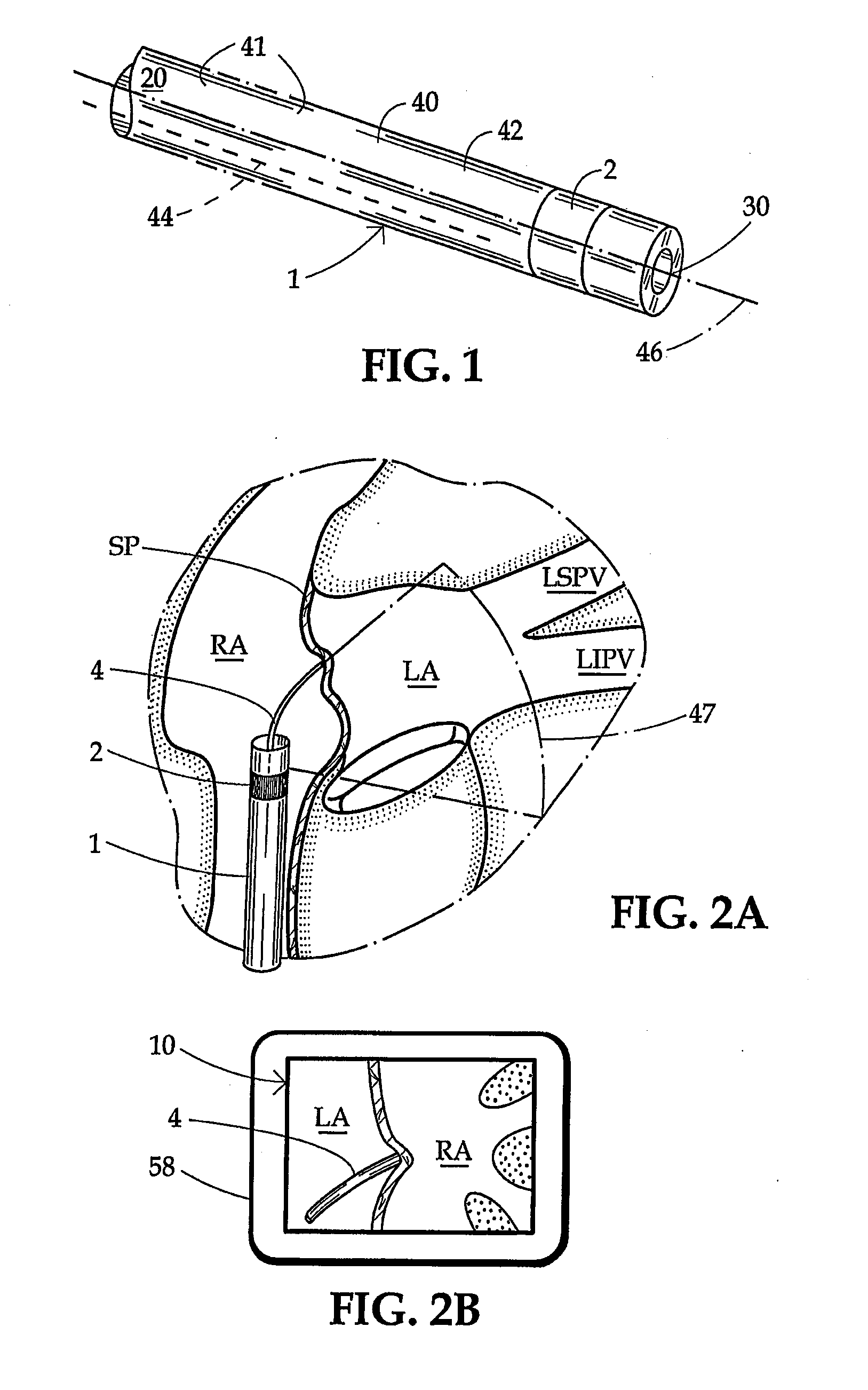 Ultrasound imaging sheath and associated method for guided percutaneous trans-catheter therapy