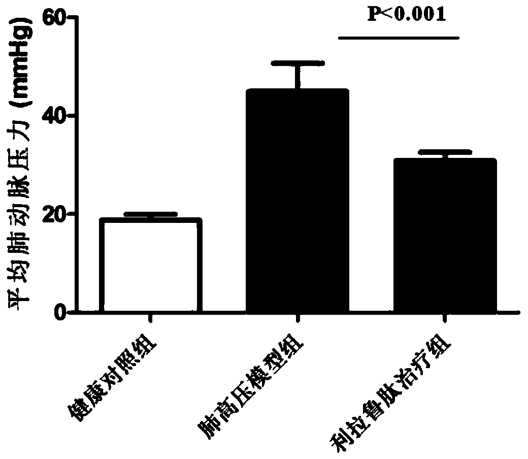 Application of Glucagon-like Peptide-1 Receptor Agonist in the Preparation of Drugs for Treating Pulmonary Arterial Hypertension