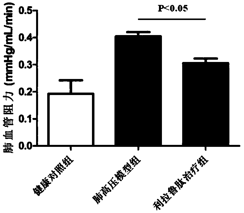 Application of Glucagon-like Peptide-1 Receptor Agonist in the Preparation of Drugs for Treating Pulmonary Arterial Hypertension