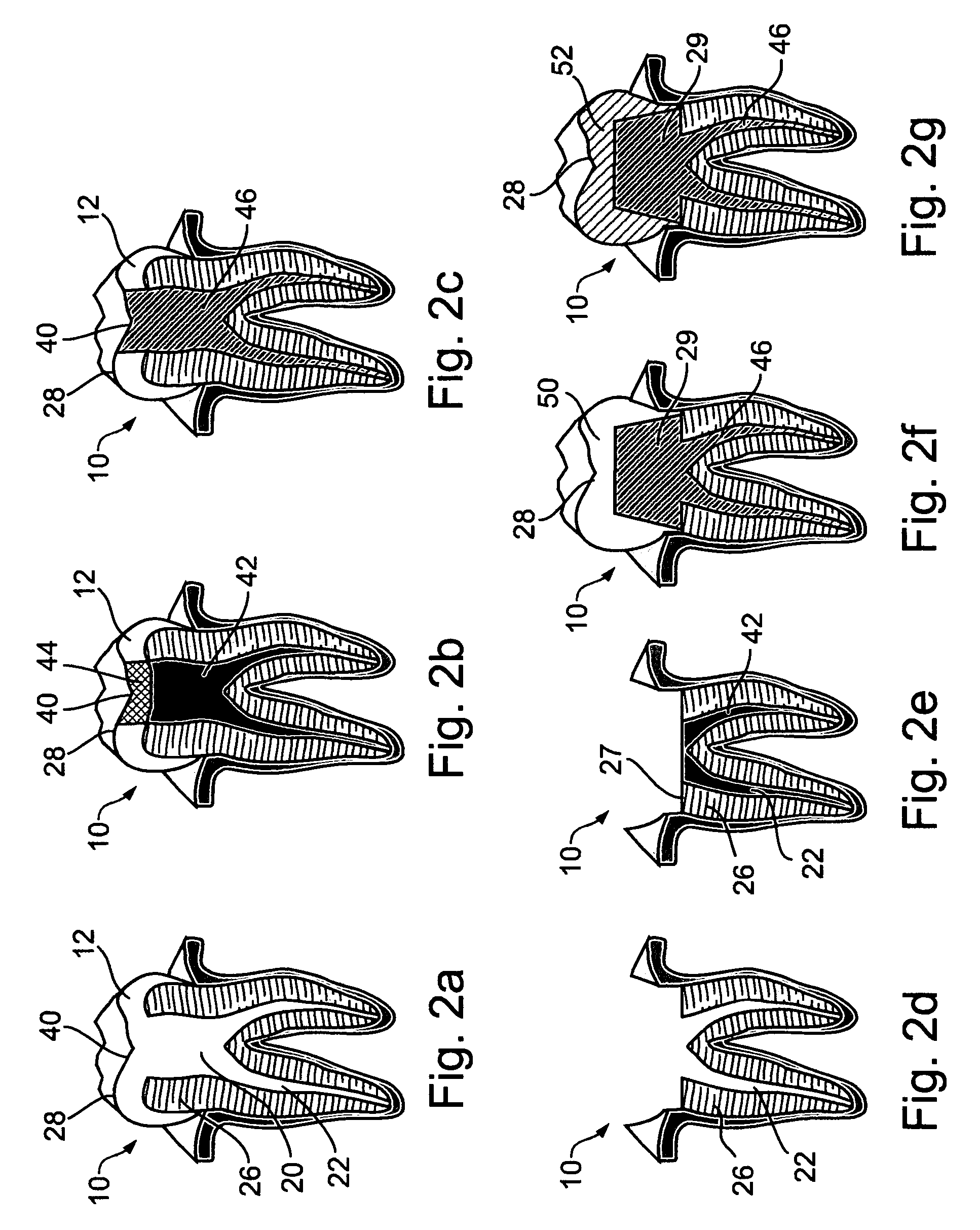 Oral devices and methods for controlled drug release