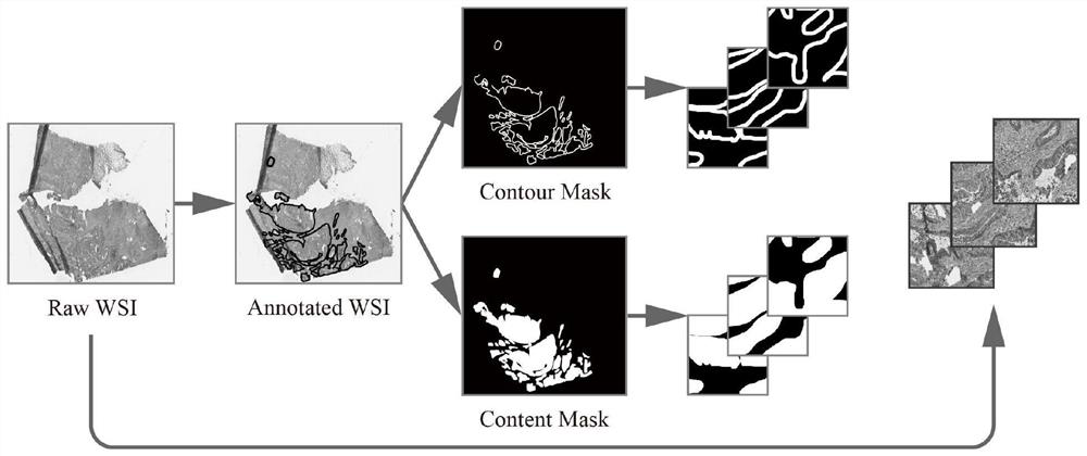 A method and system for identifying cancer focus regions based on full-slice pathological images