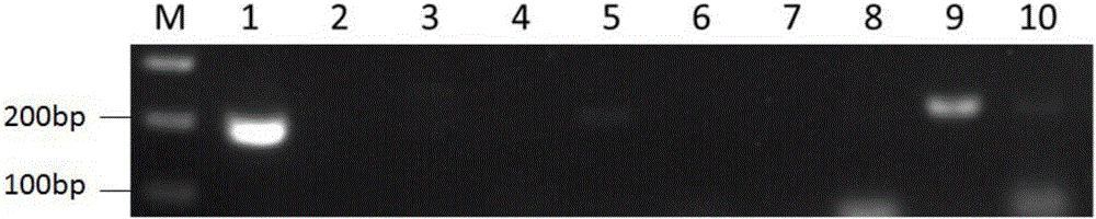 Primer group for detecting renal cancer and detecting method thereof