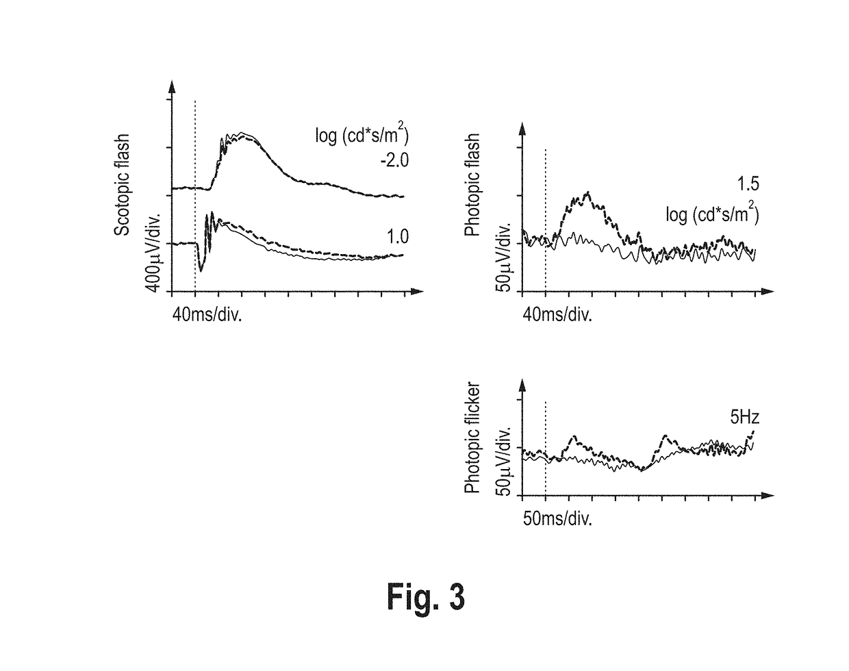 Gene therapy for the treatment of a disease of retinal cone cells