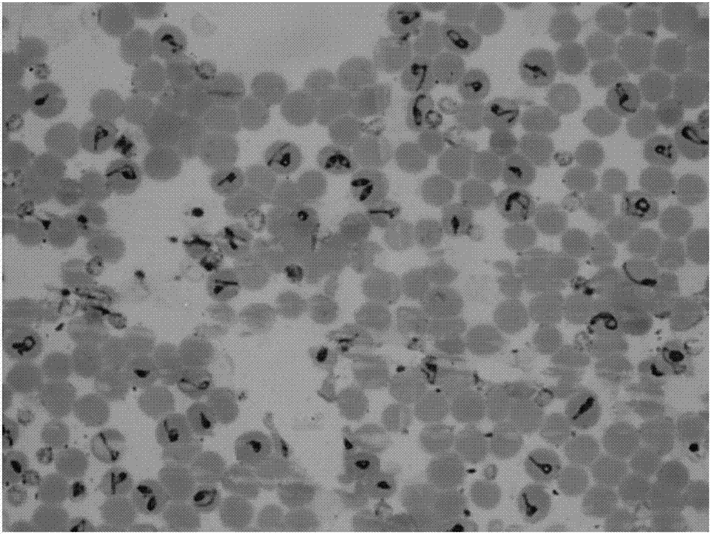 Compound staining solution of piroplasma blood smear and staining method of blood smear