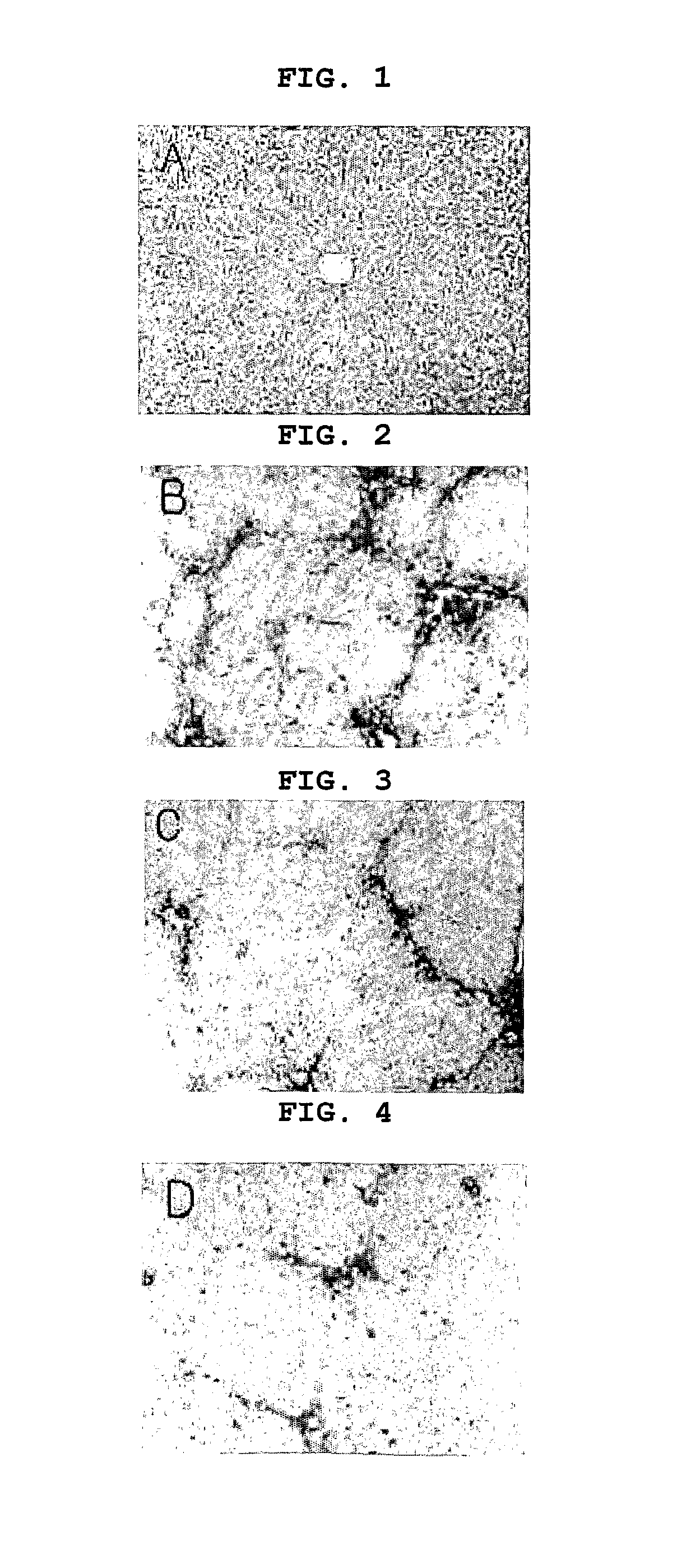 Agent for treatment of liver diseases containing pyrazolopyrimidinone derivative
