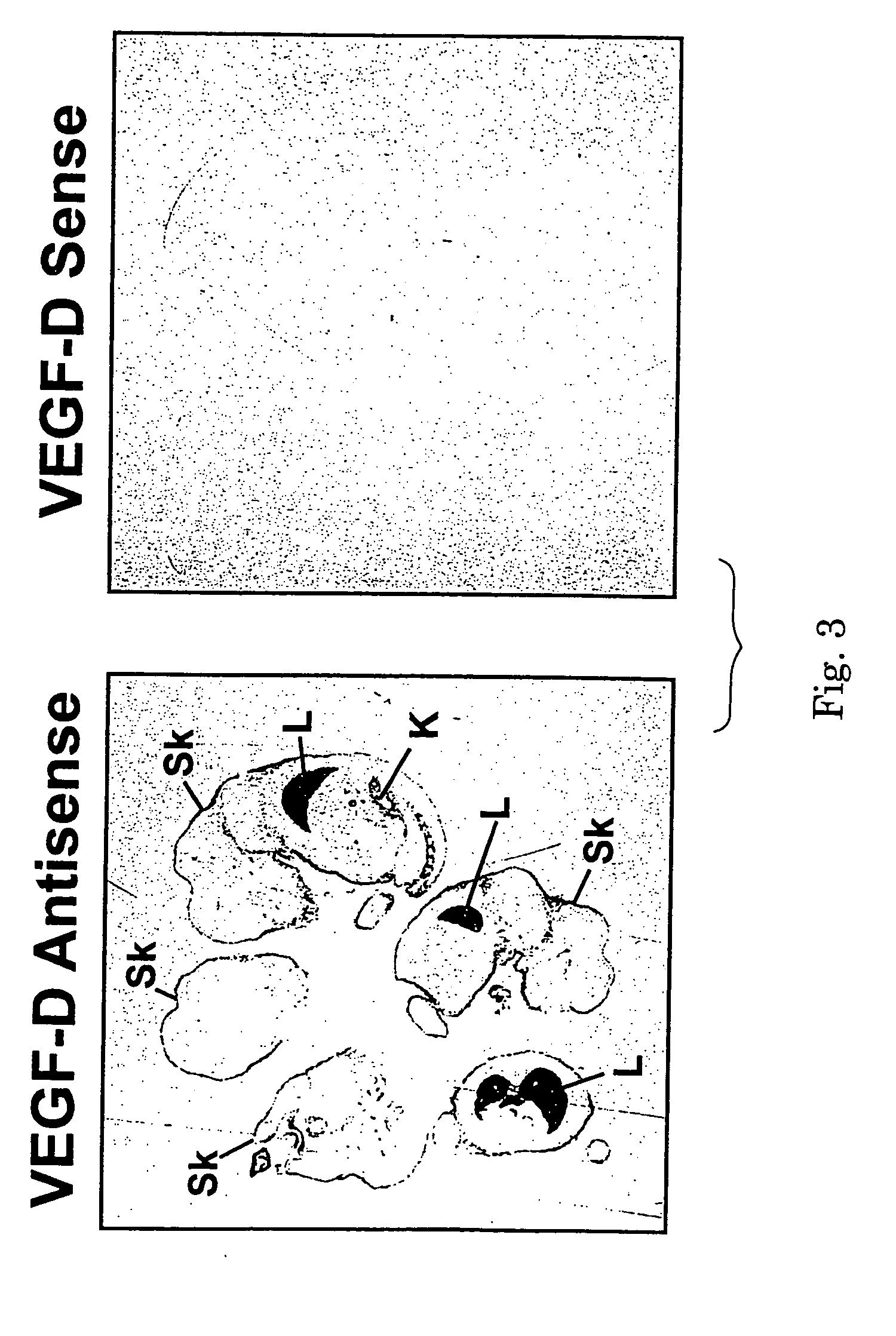 Methods for treating neoplastic disease characterized by vascular endothelial growth factor D expression, for screening for neoplastic disease or metastatic risk, and for maintaining vascularization of tissue