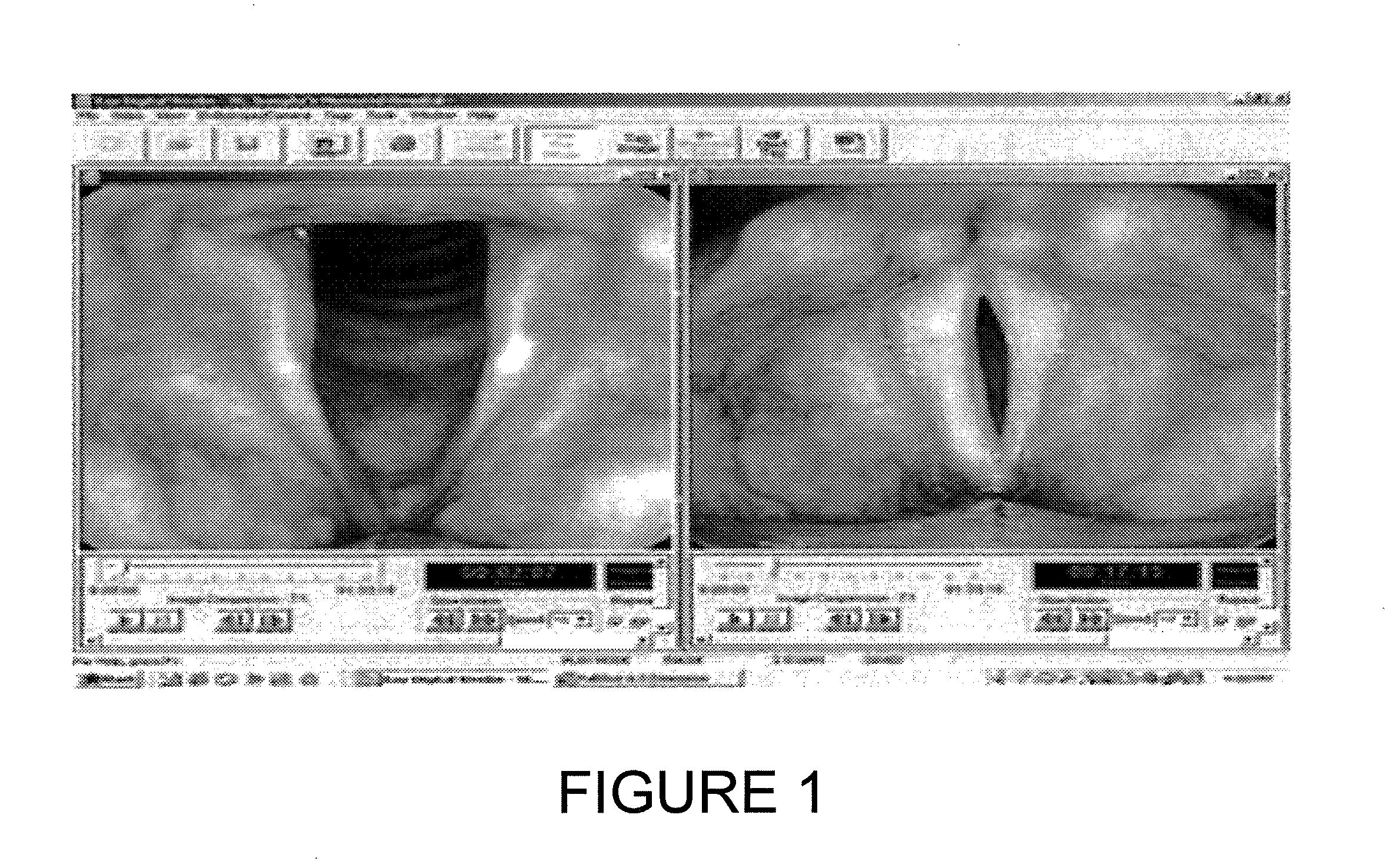 Methods and arrangements for analysis, diagnosis, and treatment monitoring of vocal folds by optical coherence tomography