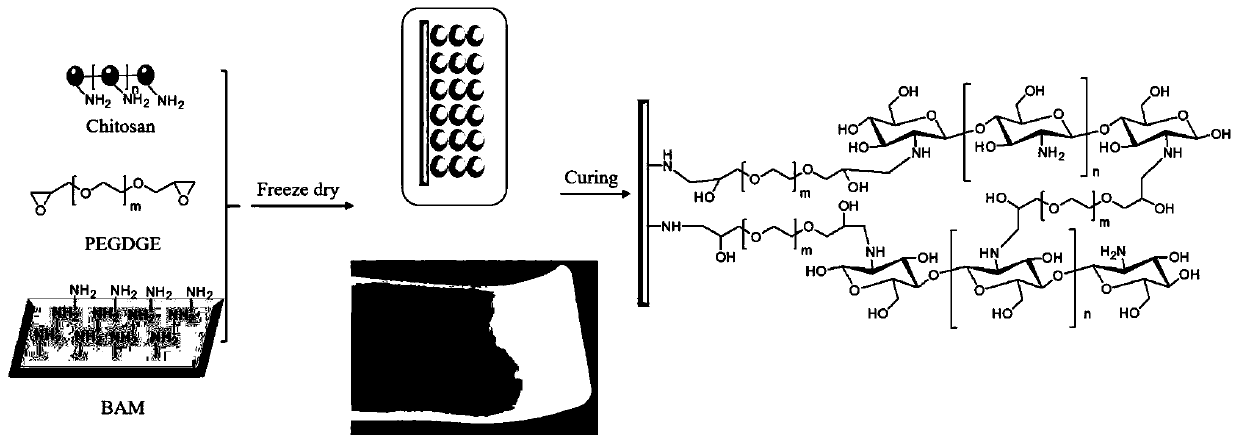 Preparation method of amnion-spongy chitosan composite double-layer wound dressing