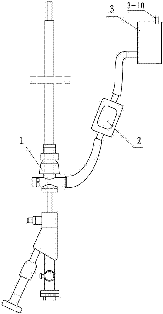Broken stone collection and filtration device with convection negative-pressure channel