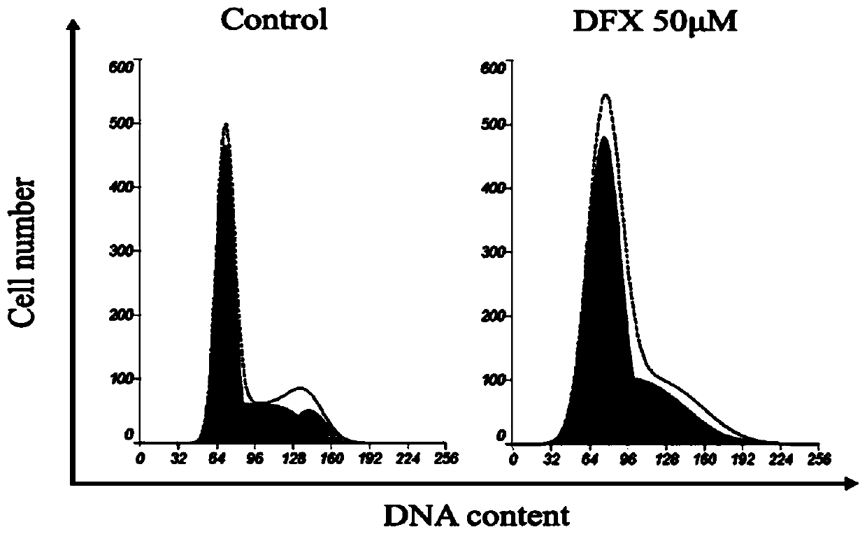 Application of iron chelator Deferasirox (DFX) in drug for treating cervical cancer
