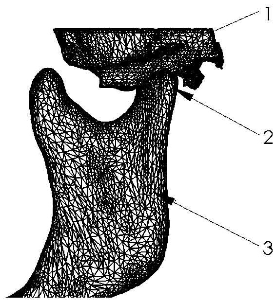 Temporomandibular joint separation cap and fixing method thereof