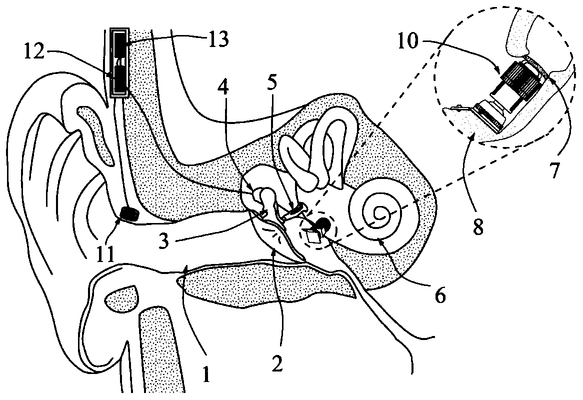 A round window excitation type artificial middle ear actuator capable of monitoring initial pressure