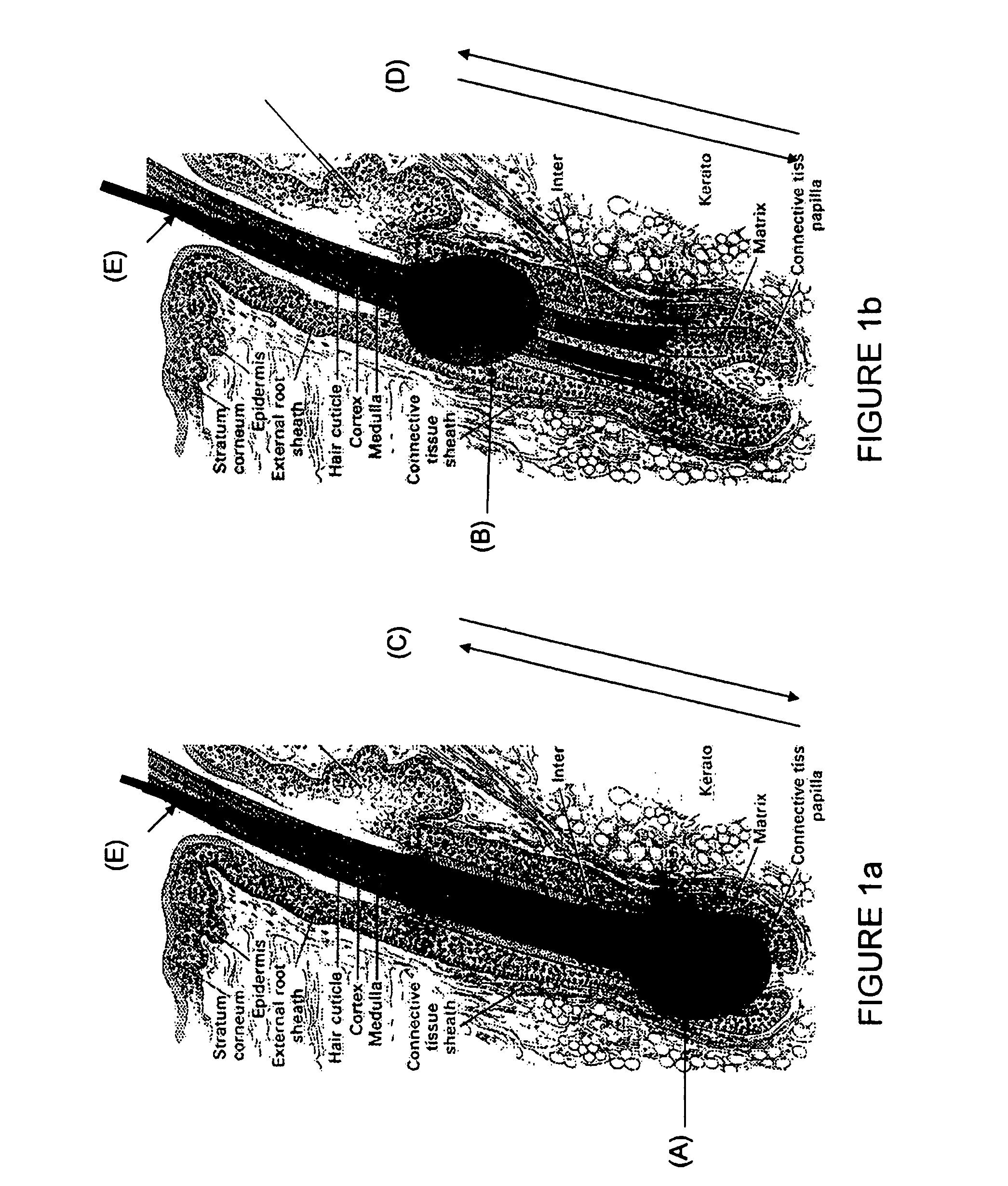 Electro-epilation method