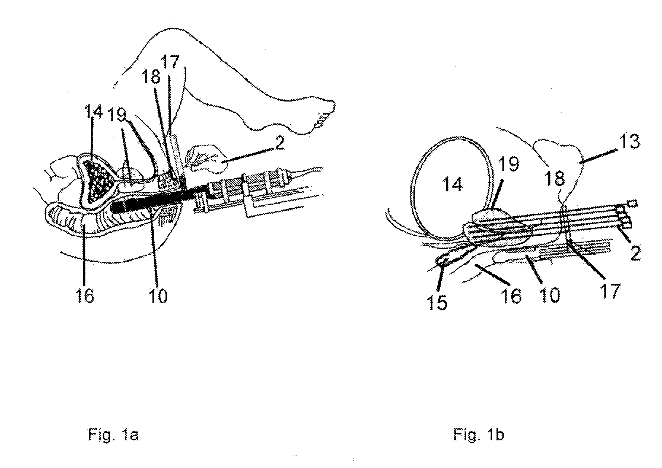 Apparatus and method for guiding insertion of a medical tool
