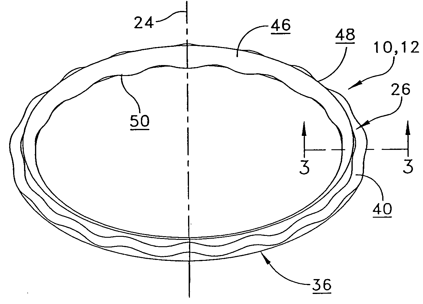 O-ring for incrementally adjustable incision liner and retractor