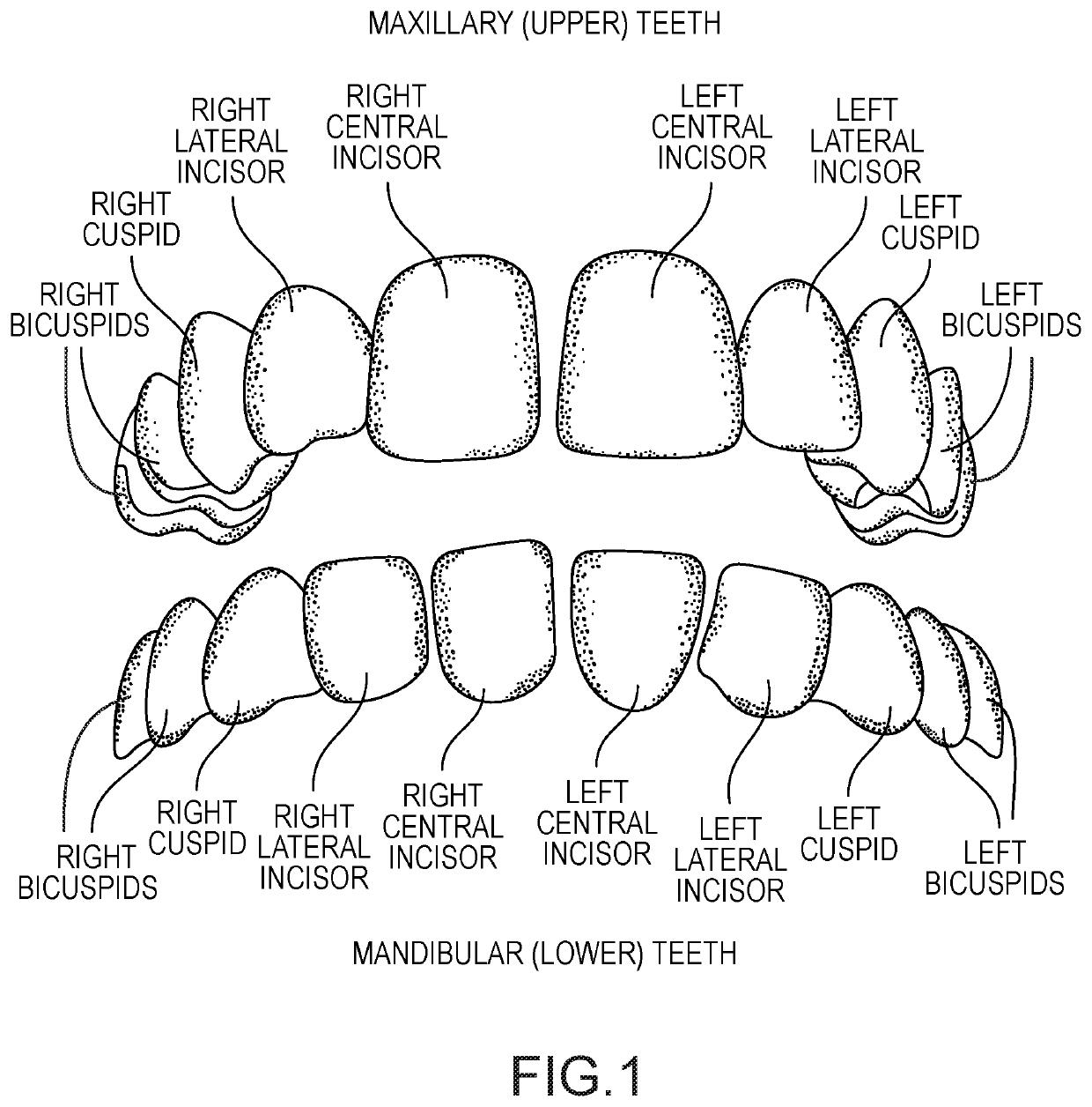 Orthotic devices & methods for treating complications of the masticatory neuromusculature