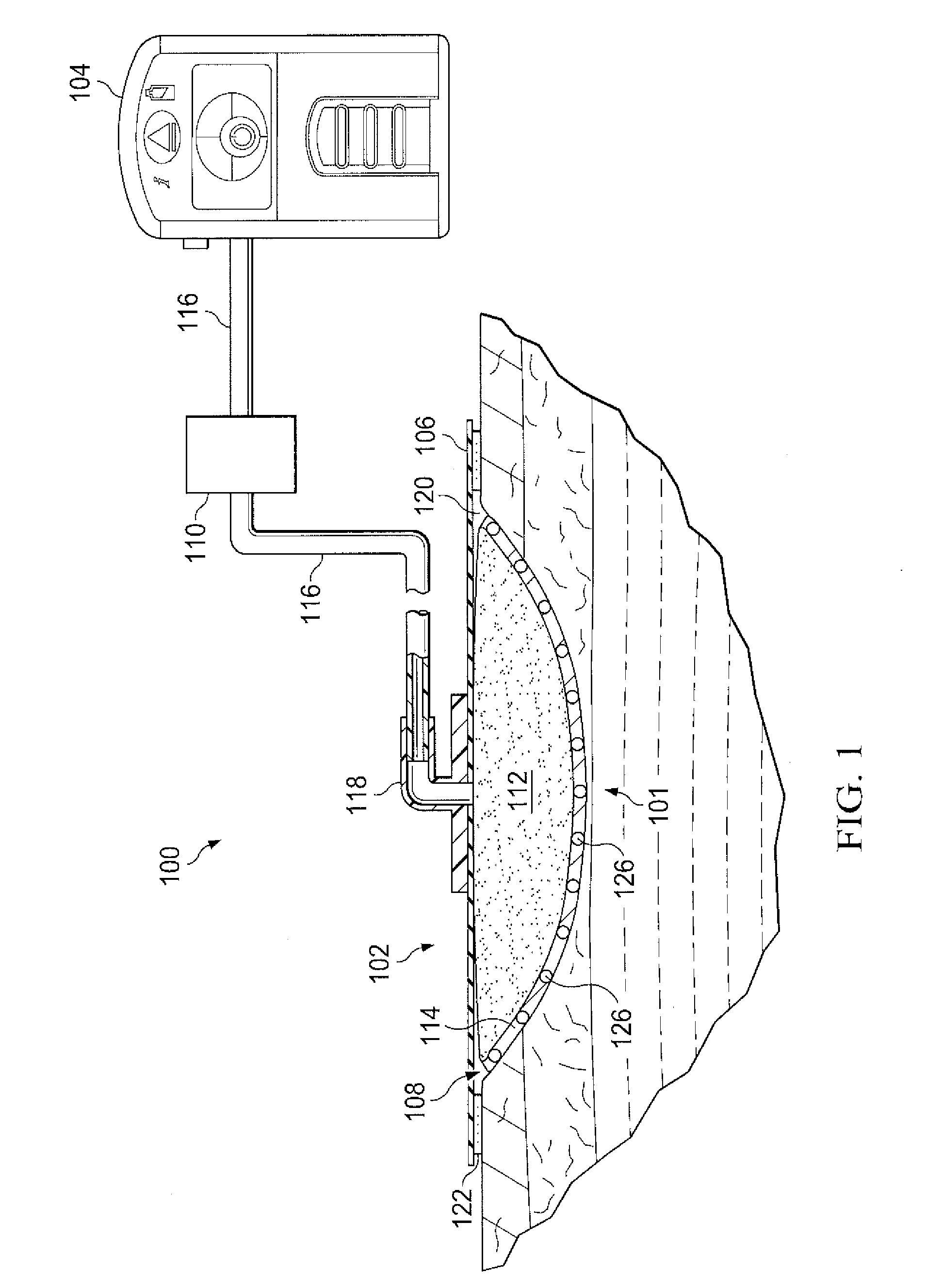 Protease modulating wound interface layer for use with negative pressure wound therapy