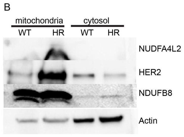 Application of NDUFA4L2 in drug resistance of herceptin