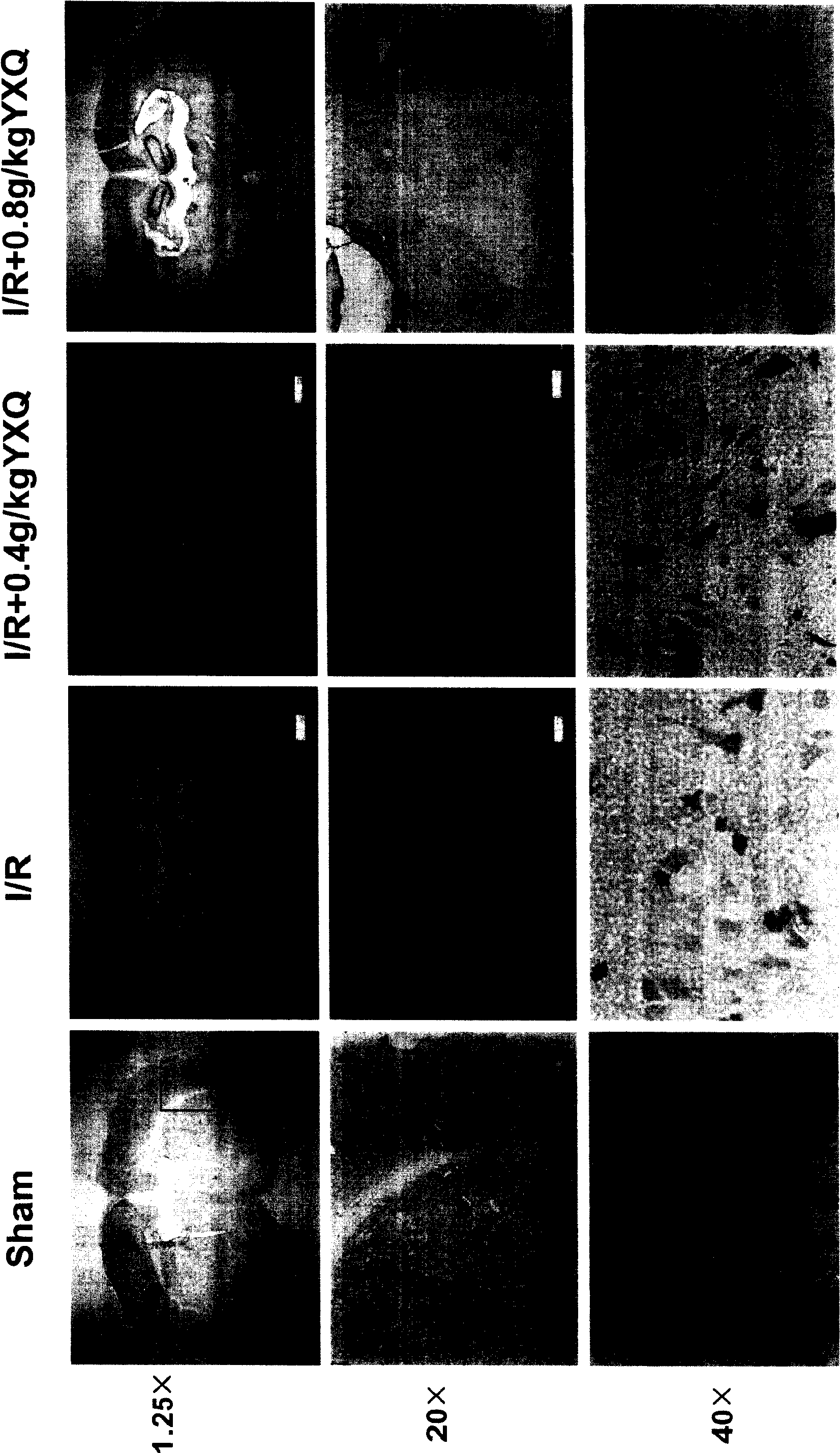 Therapeutic effect of blood-nourishing and brain-refreshing granules on trauma of cerebral nerve cell