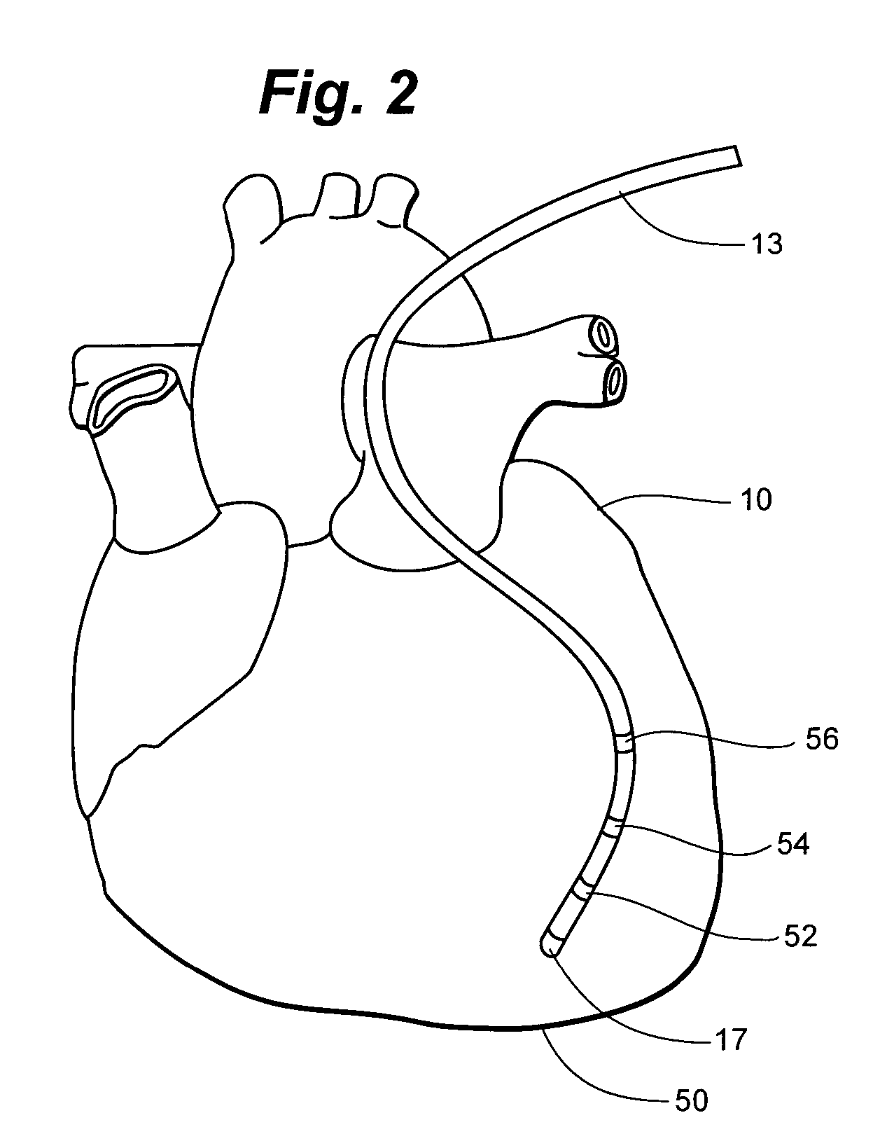 Method and apparatus for catheter navigation and location and mapping in the heart