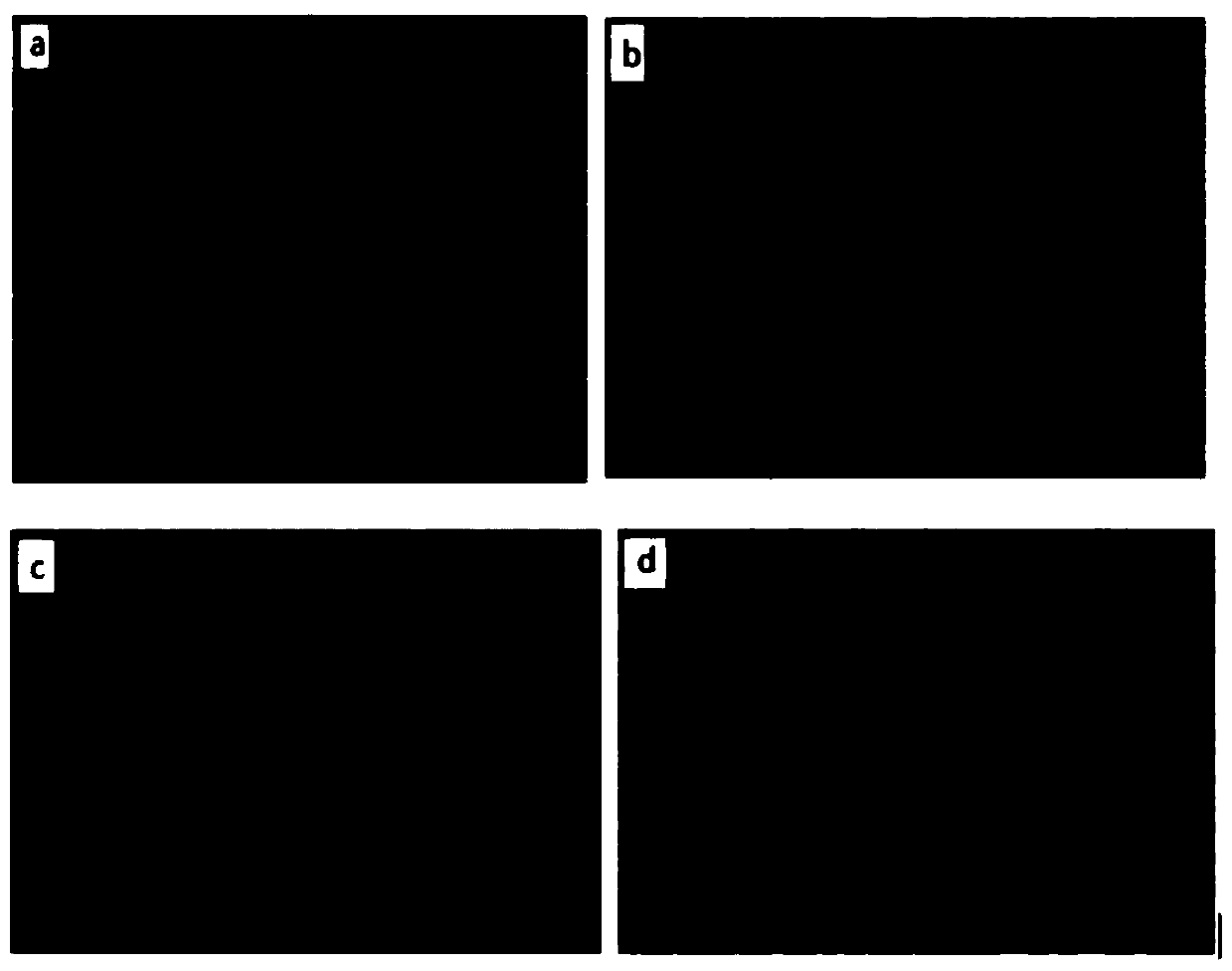 Traditional Chinese medicine composition for treatment of liver lenticular degeneration hepatic fibrosis and application