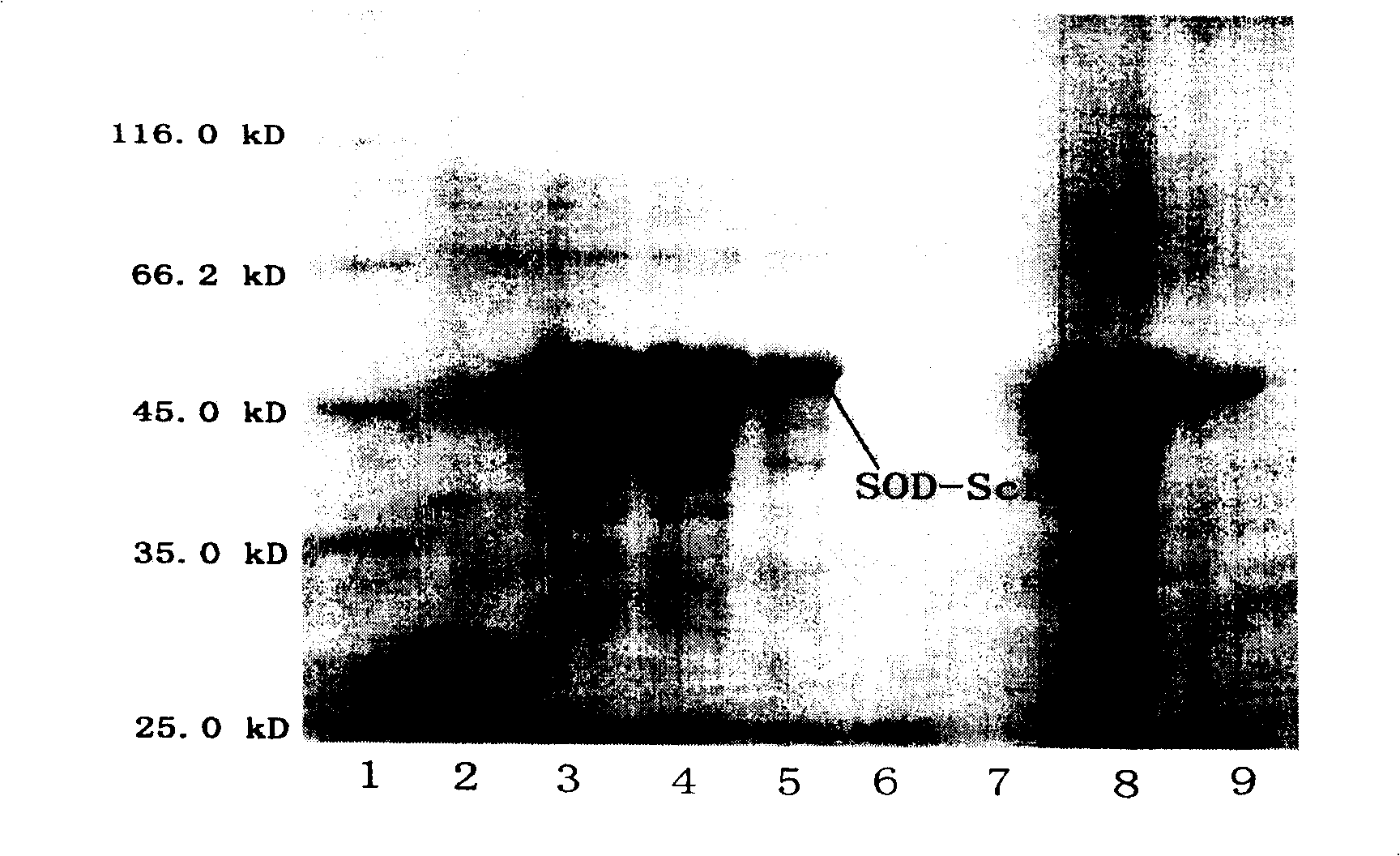 Targeted anti-lung carcinoma SOD construction and expression method