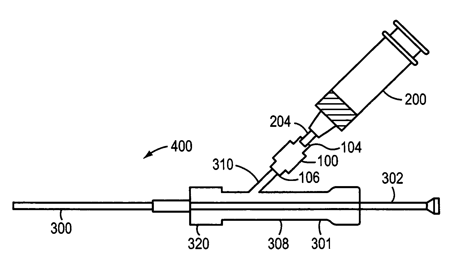 Syringe activated-valve for flushing a catheter and methods thereof