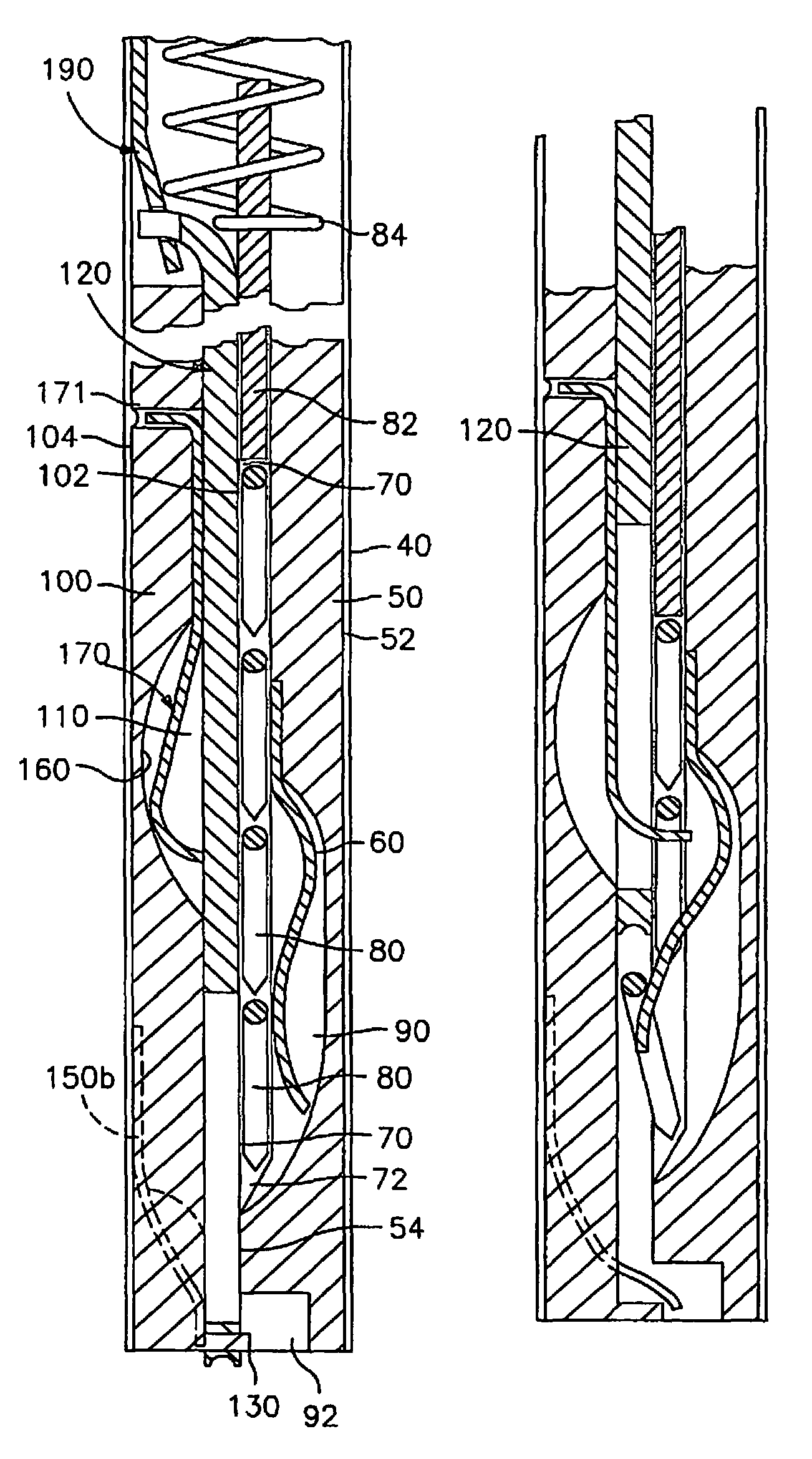 Apparatus and method for surgical fastening