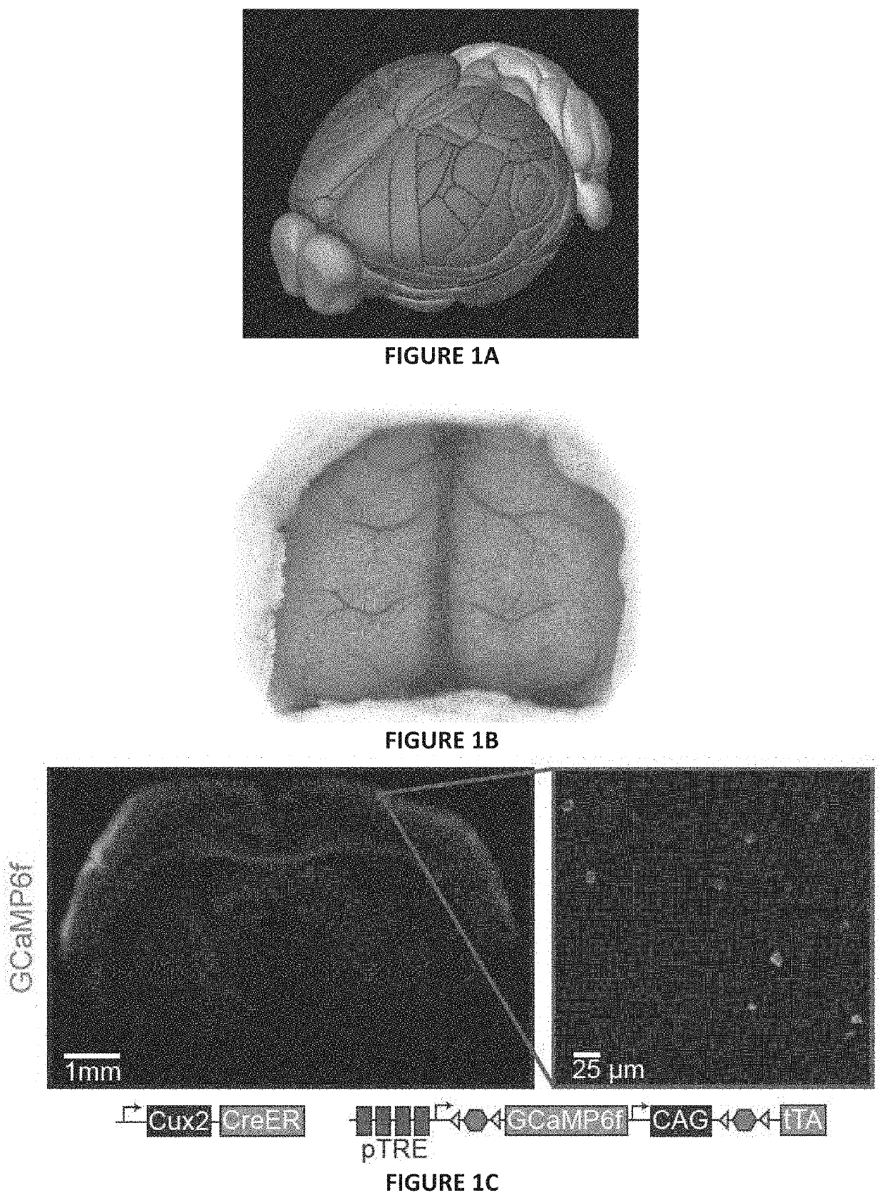 Multifocal macroscope for large field of view imaging of dynamic specimens