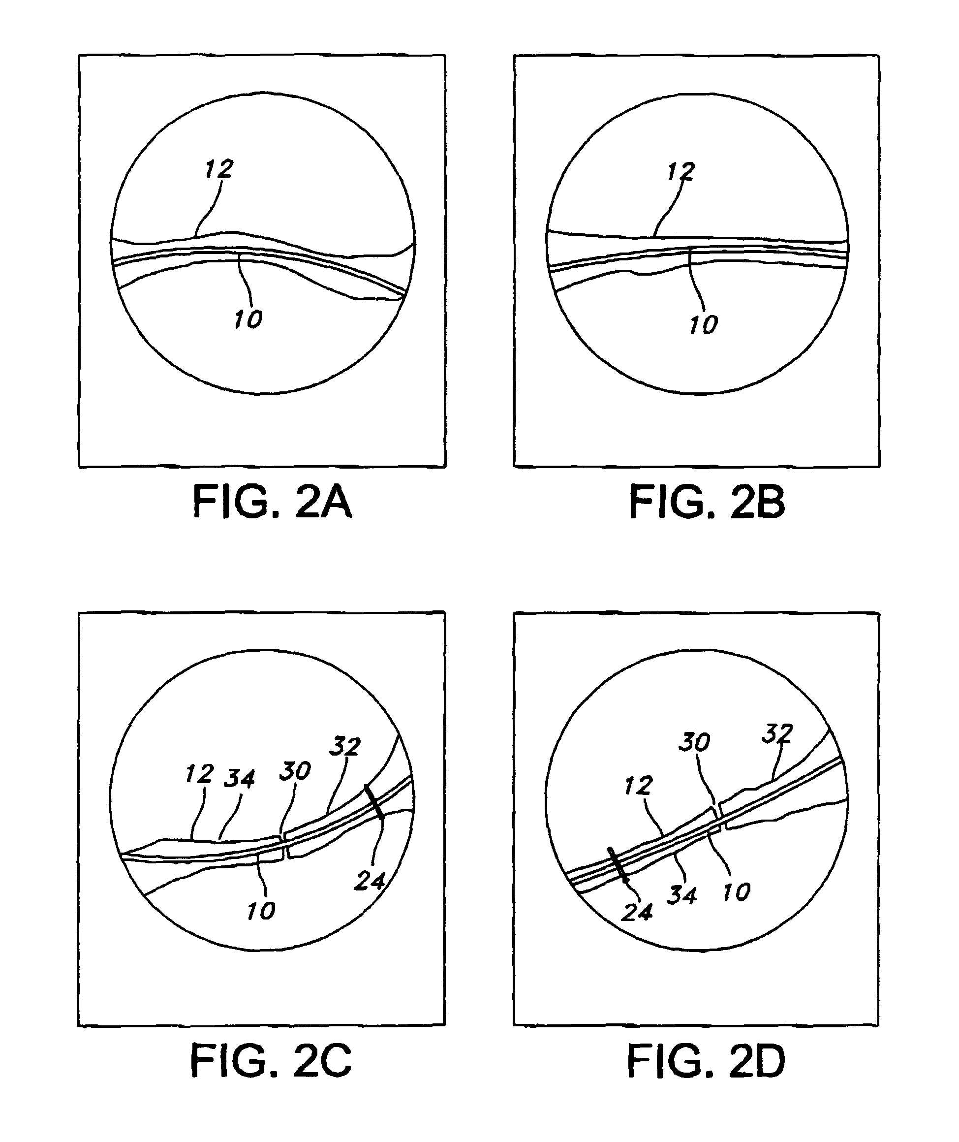 Pre-curved intramedullary clavicle nail and method of using same