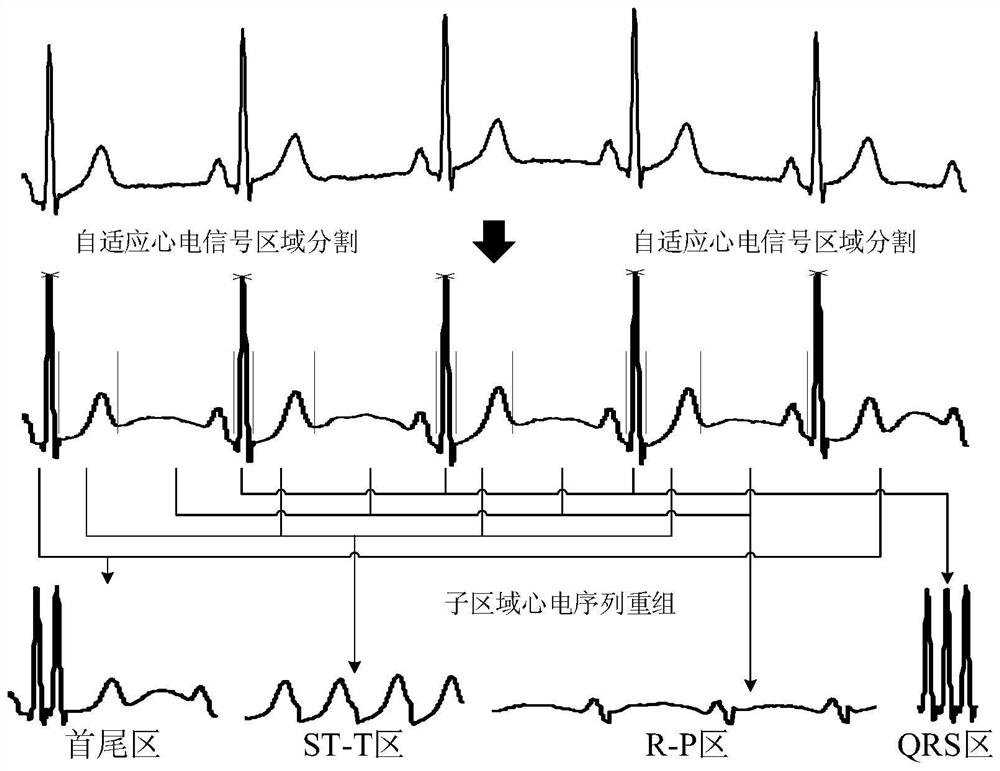 A Standard 12-Lead ECG Segmented Linear Reconstruction Method Based on Adaptive ECG Signal Region Segmentation