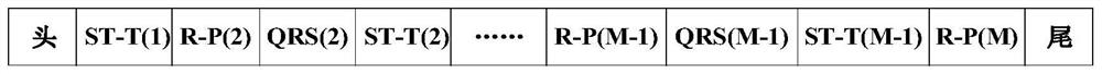 A Standard 12-Lead ECG Segmented Linear Reconstruction Method Based on Adaptive ECG Signal Region Segmentation