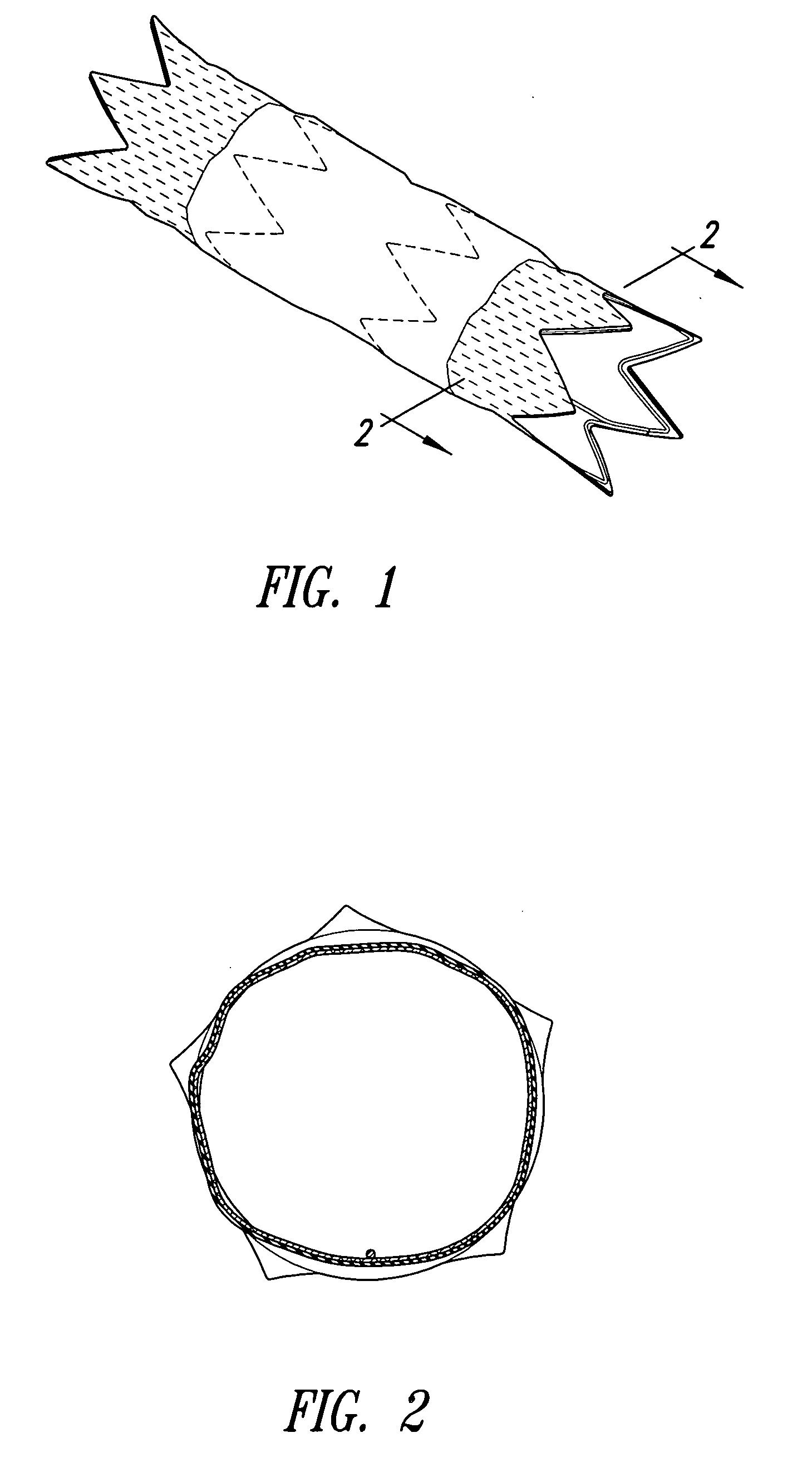 Stent grafts with bioactive coatings