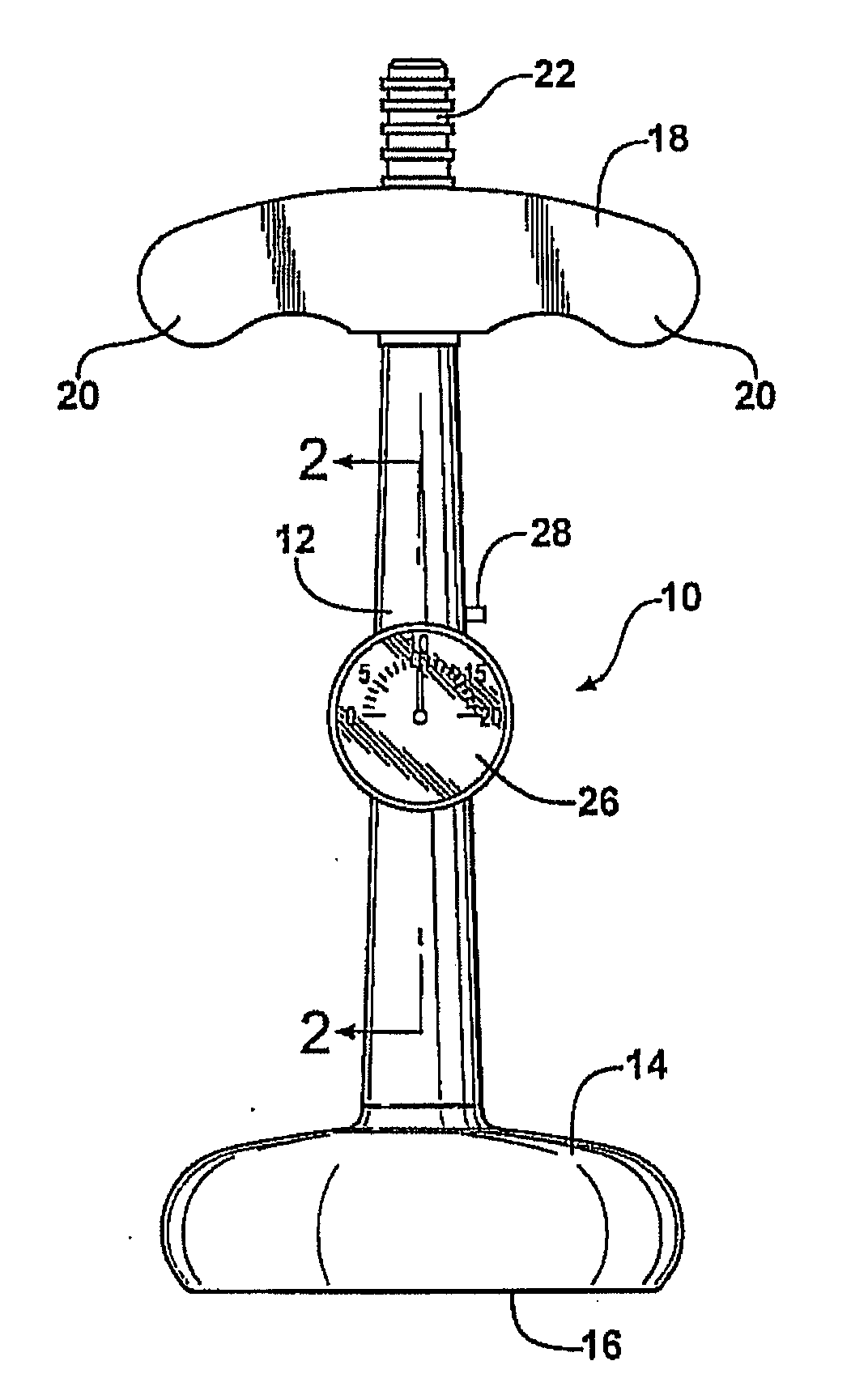 Obstetrical vacuum extractor with over-traction release