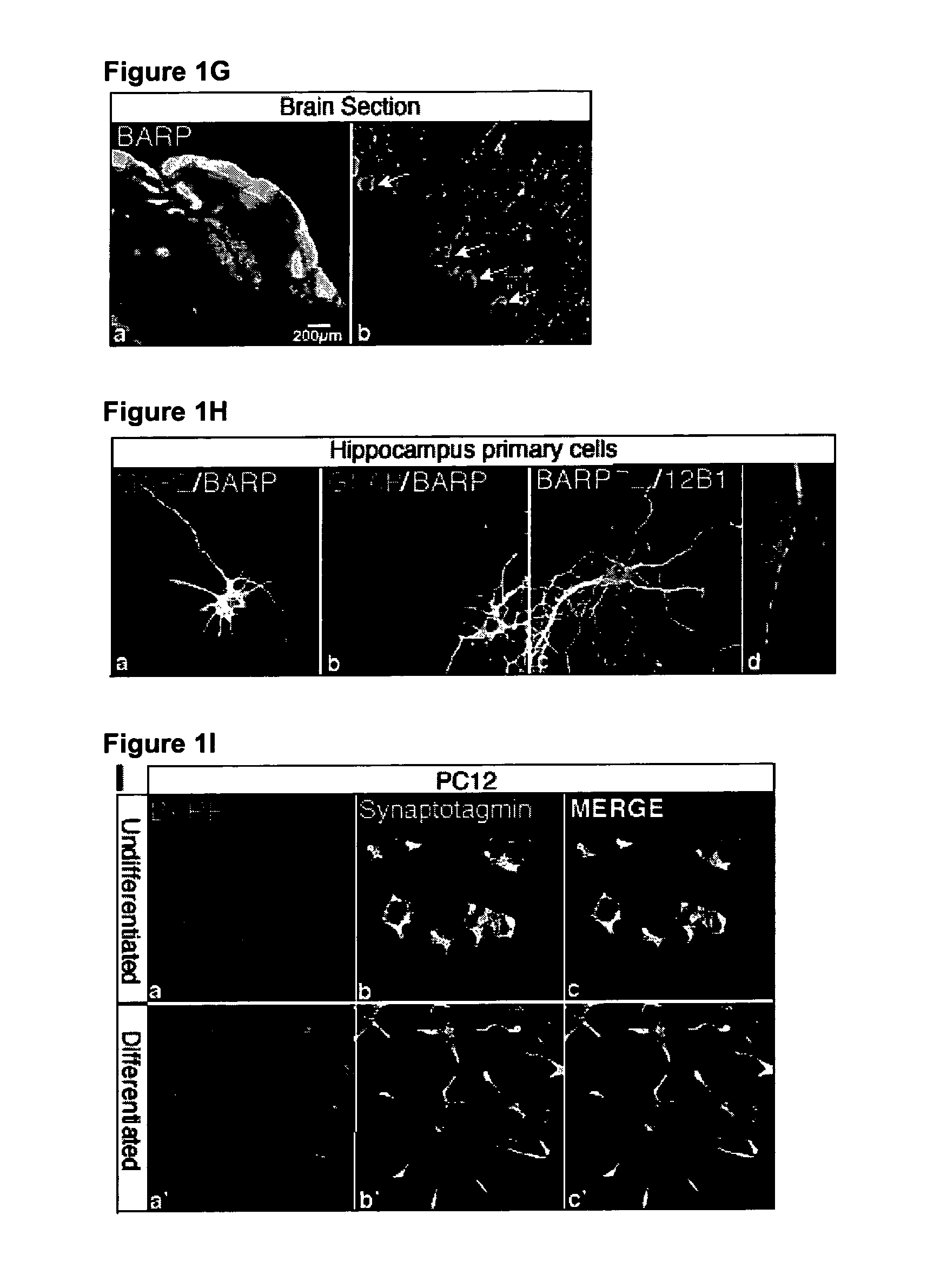 Voltage gated calcium channel β-subunit anchoring regulator protein and uses thereof