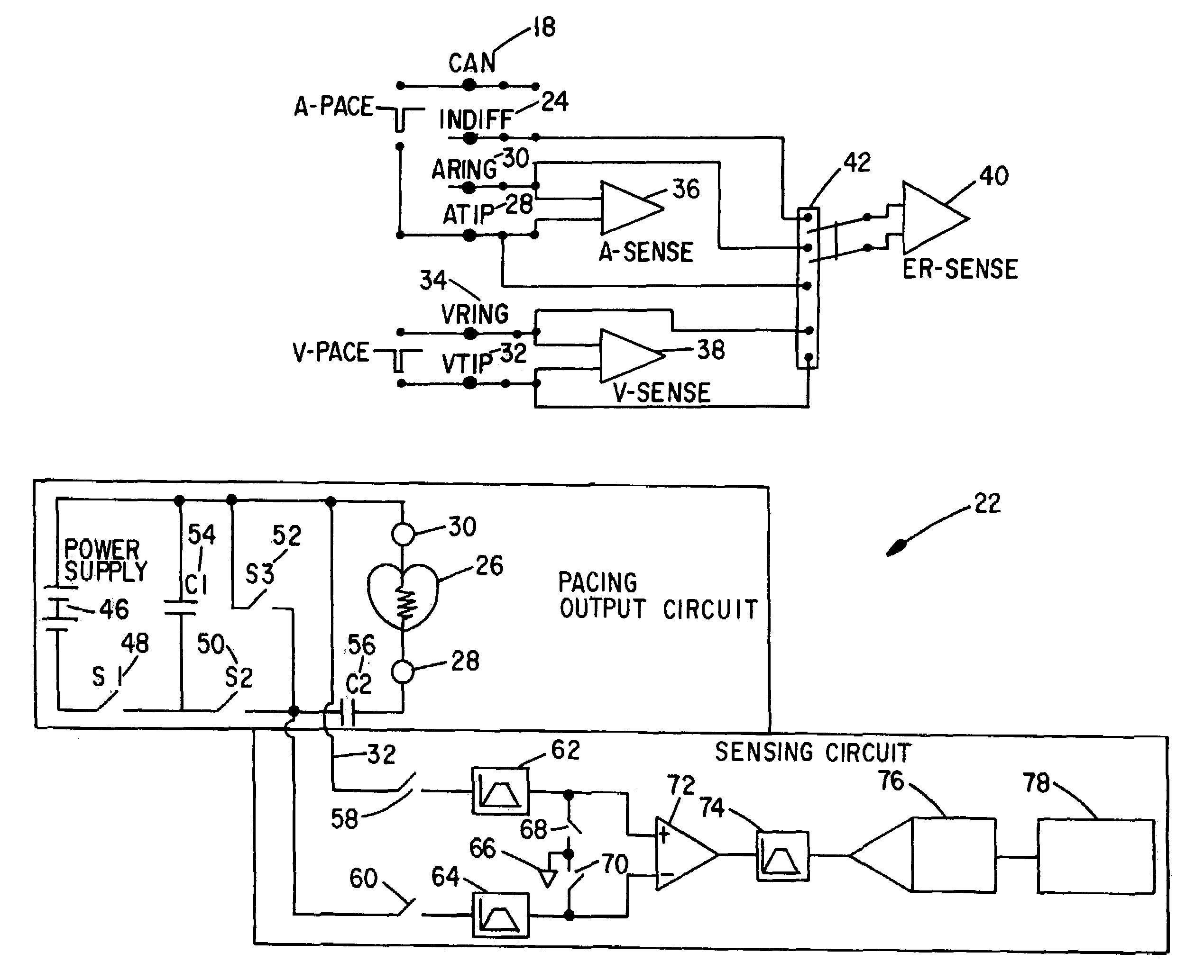 Autocapture pacing/sensing configuration