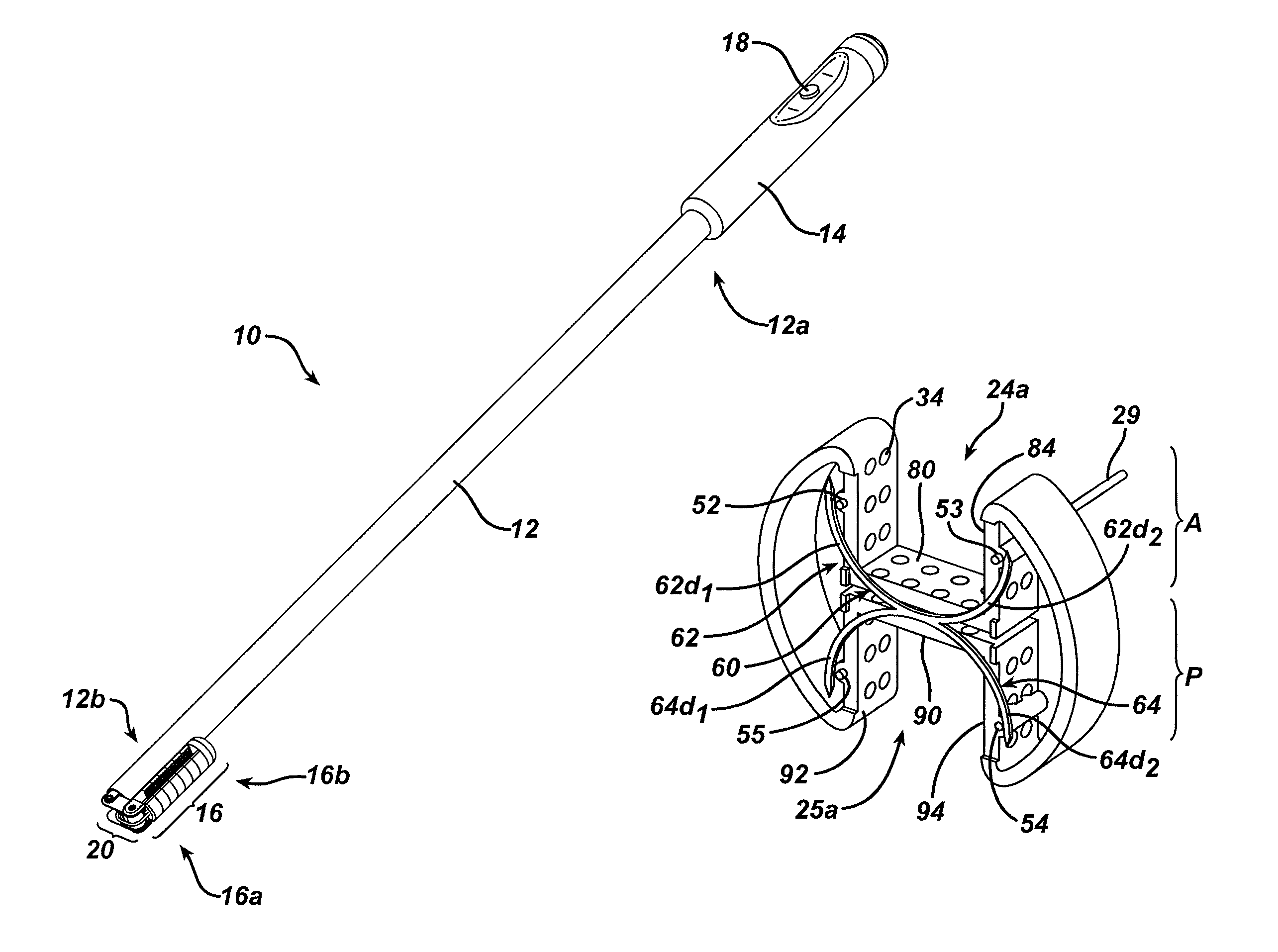 Absorbable gastric restriction devices and methods