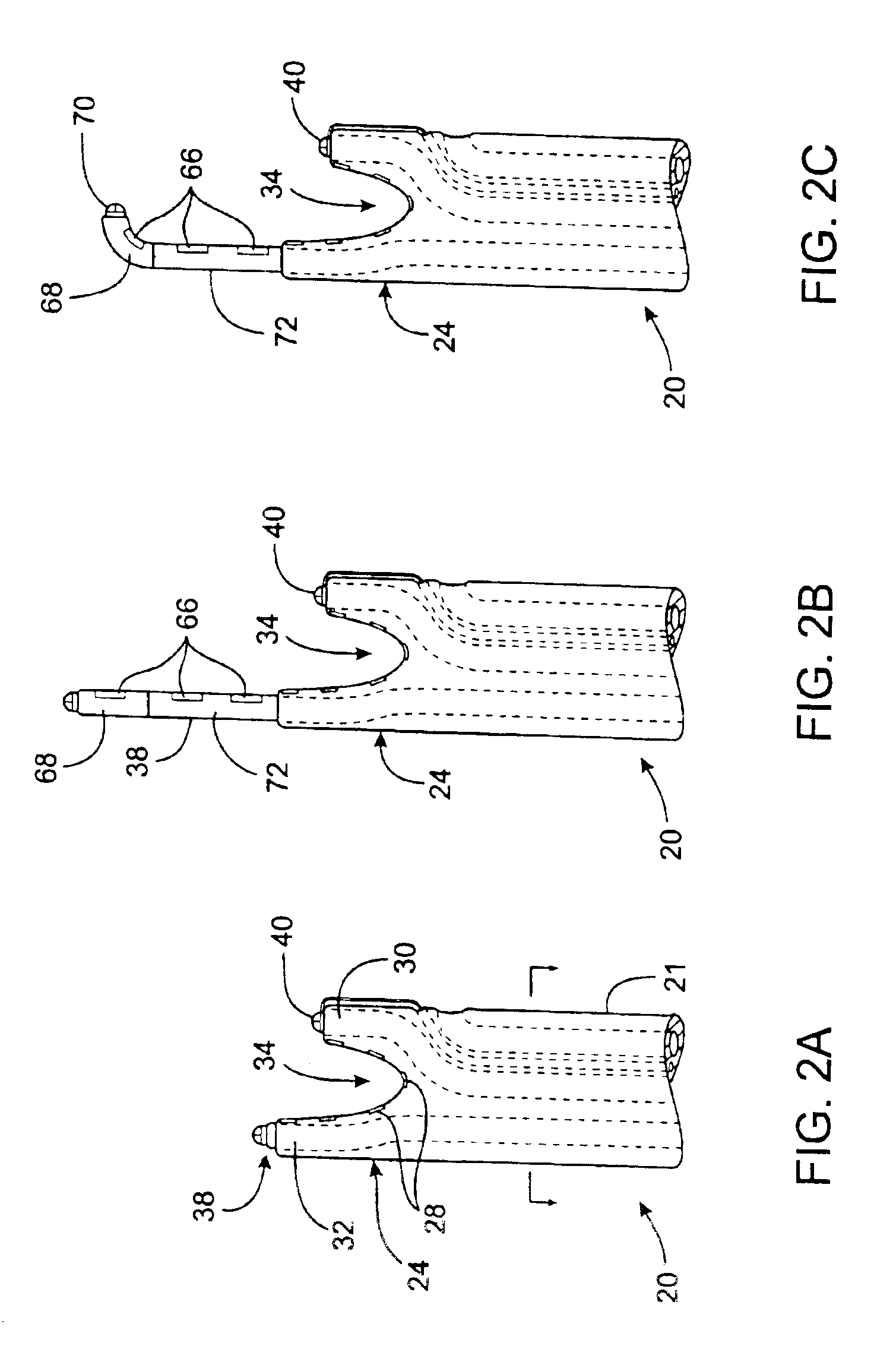 Apparatus and method for diagnosis and therapy of electrophysiological disease