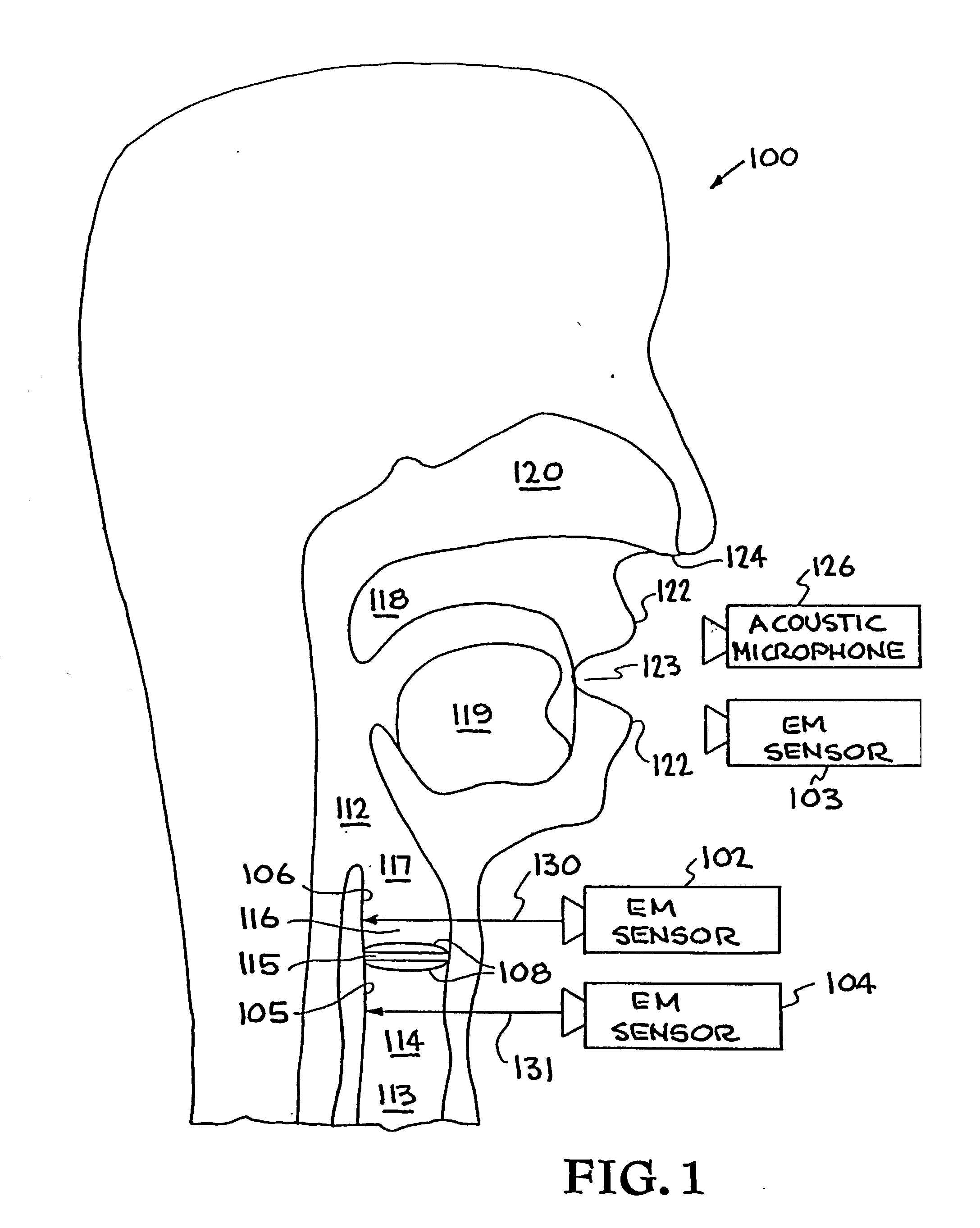 System and method for characterizing voiced excitations of speech and acoustic signals, removing acoustic noise from speech, and synthesizing speech
