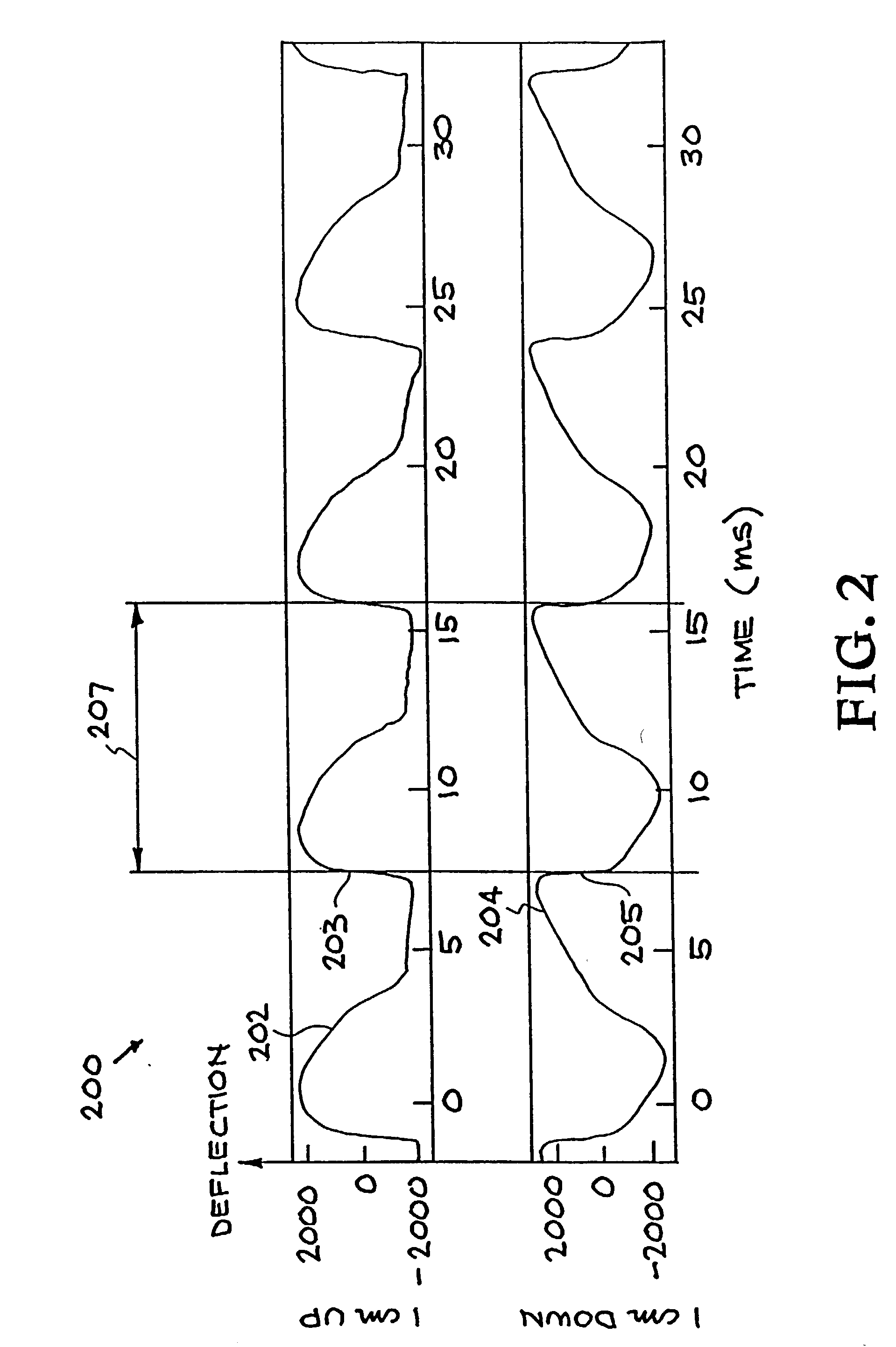 System and method for characterizing voiced excitations of speech and acoustic signals, removing acoustic noise from speech, and synthesizing speech