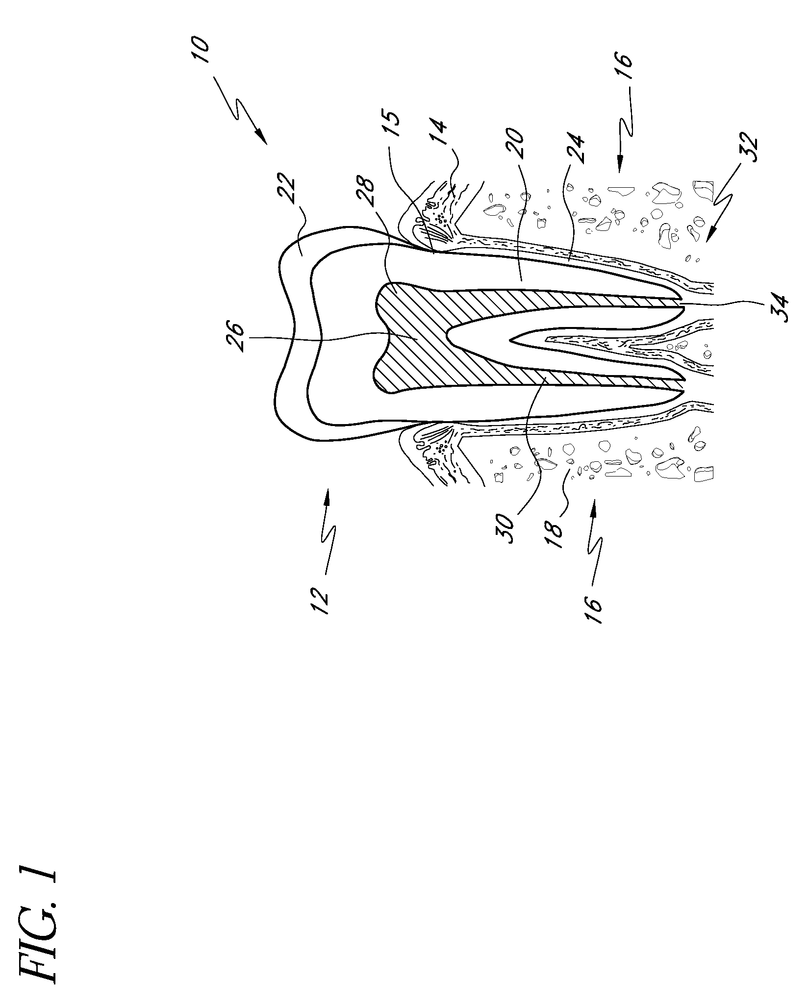 Root canal filling materials and methods