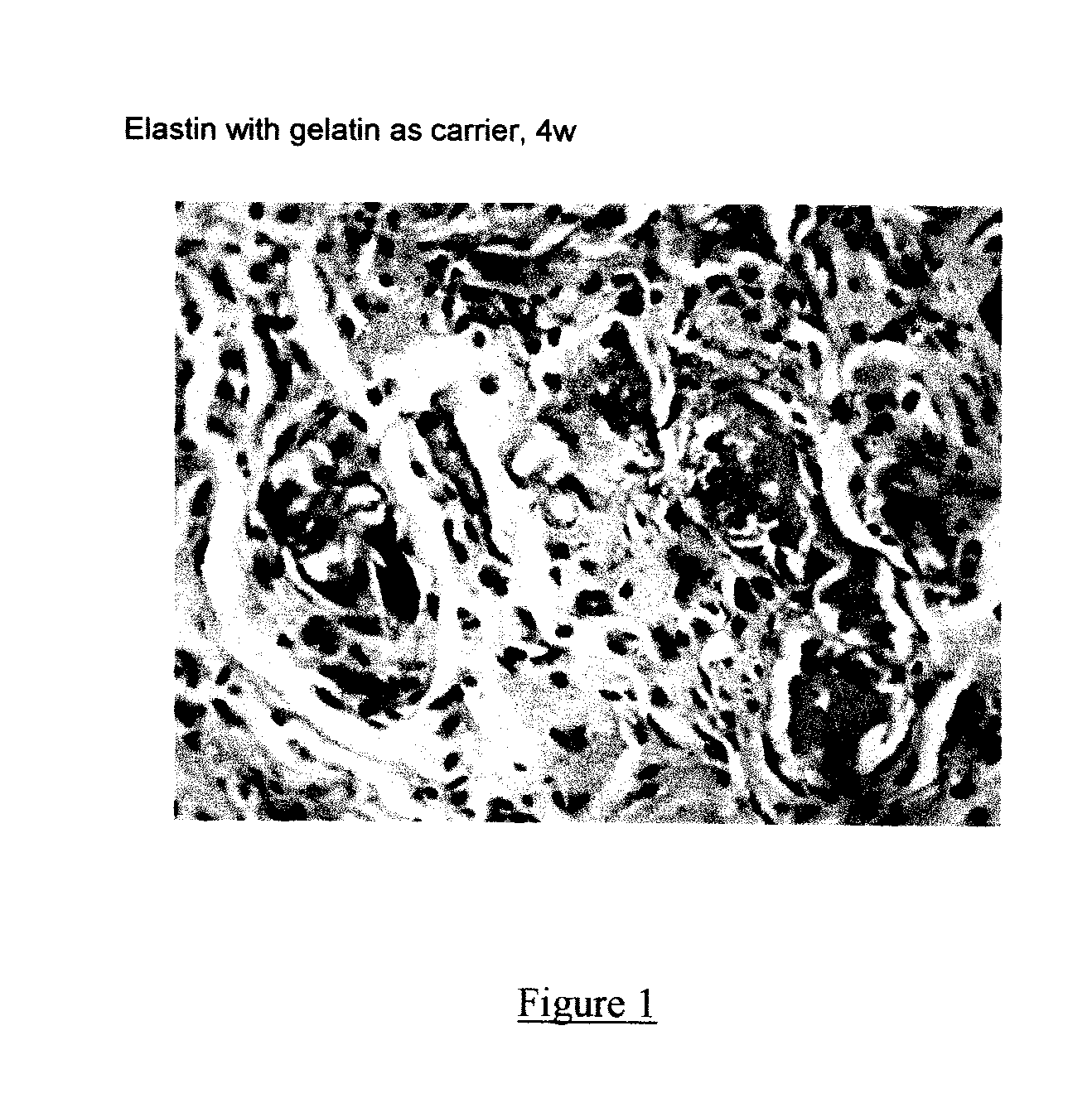 Composite containing collagen and elastin as a dermal expander and tissue filler