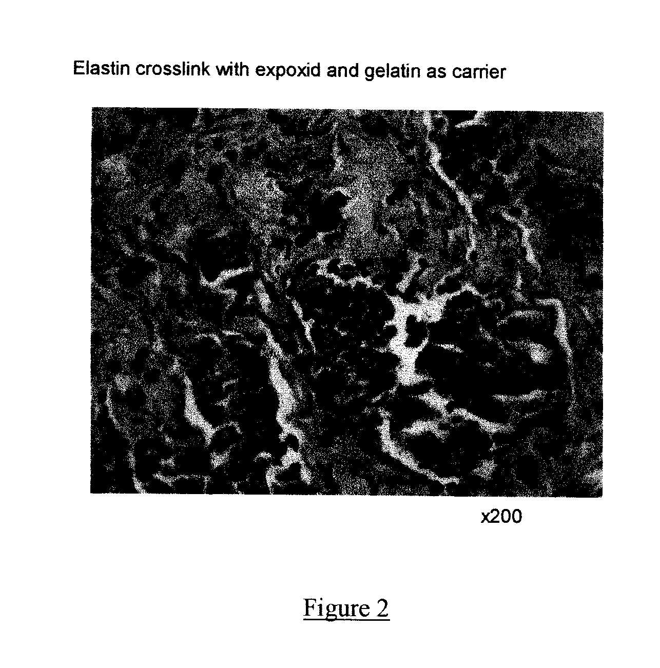 Composite containing collagen and elastin as a dermal expander and tissue filler